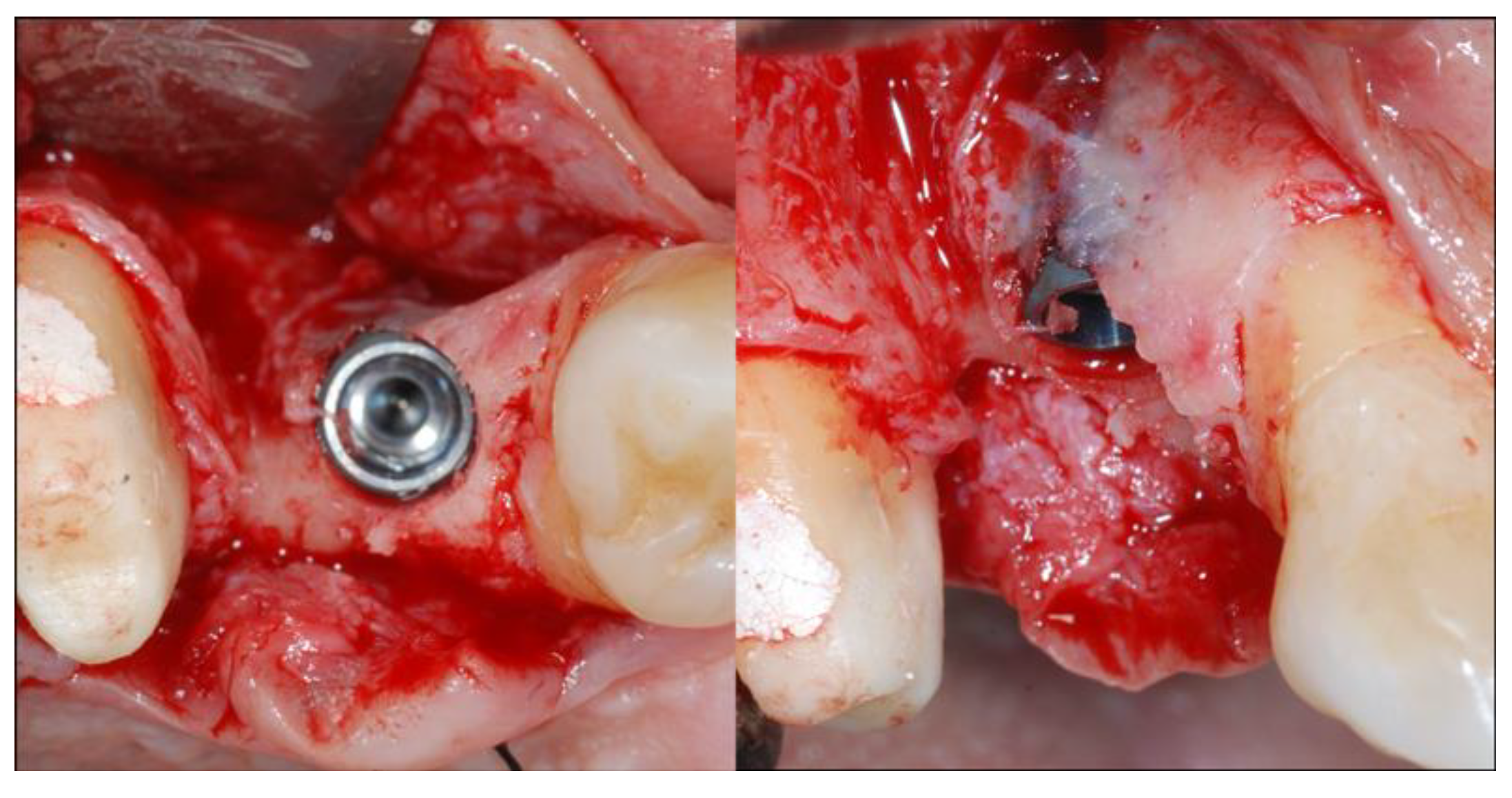 Materials 13 02389 g003