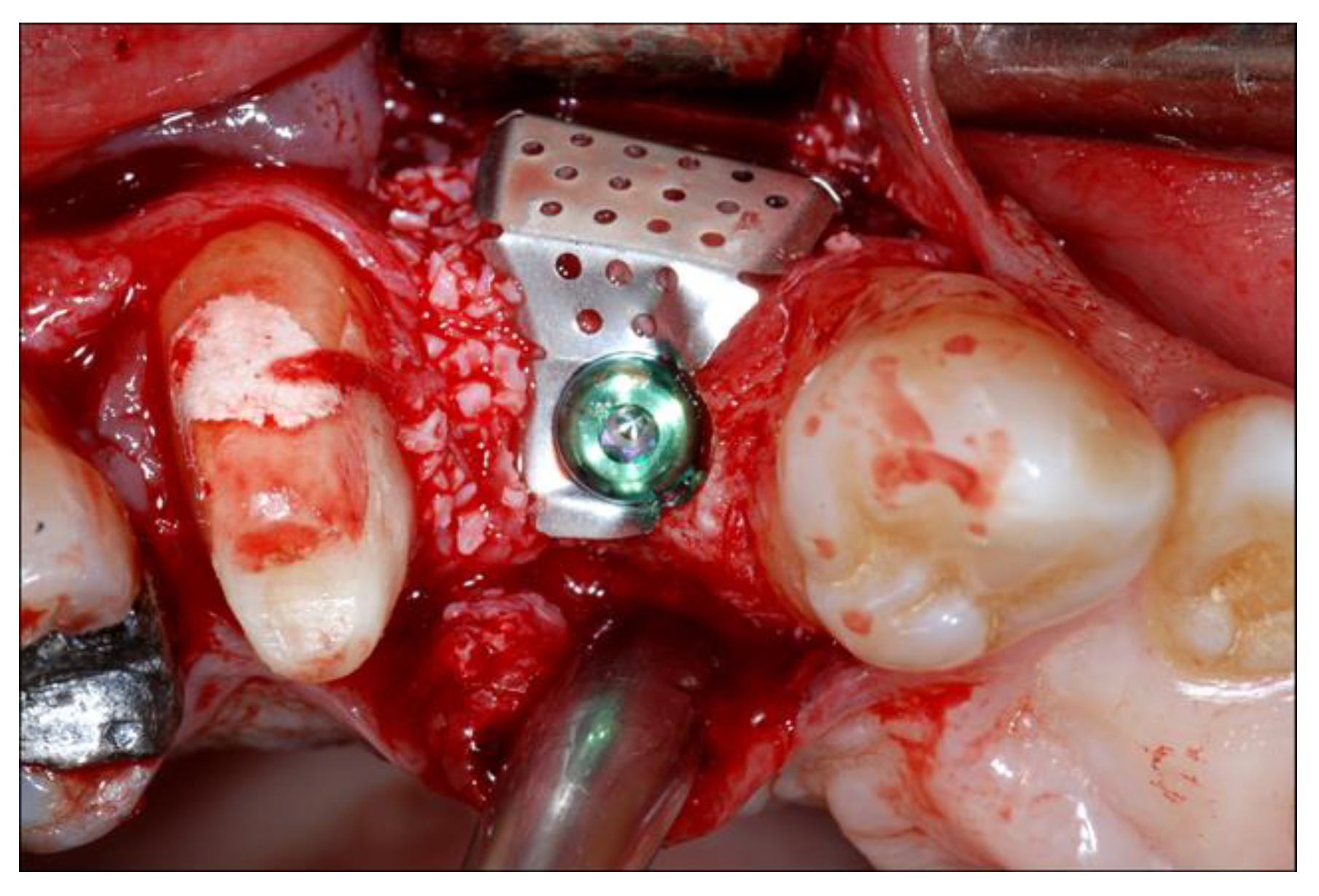 Materials 13 02389 g004