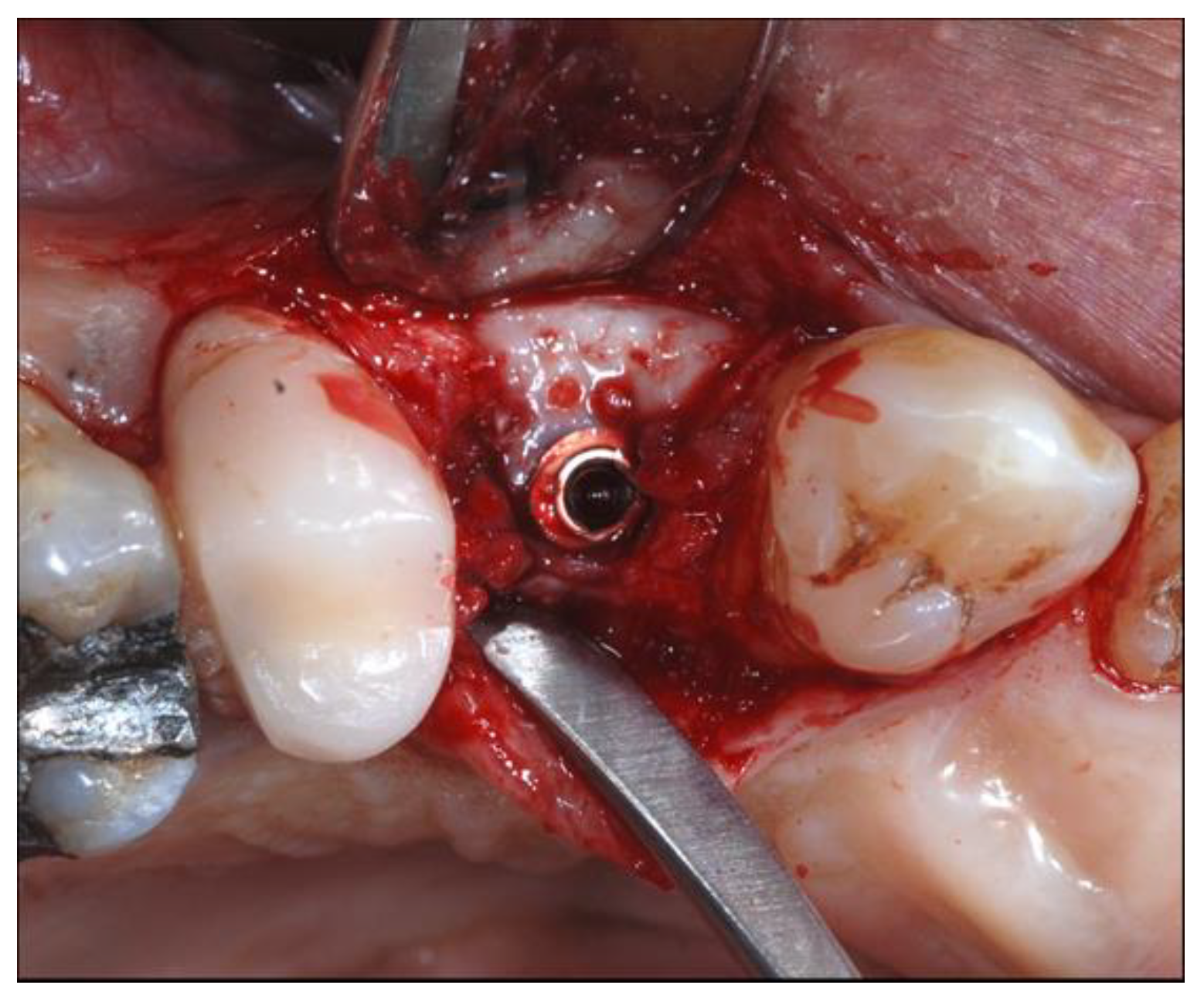 Materials 13 02389 g005