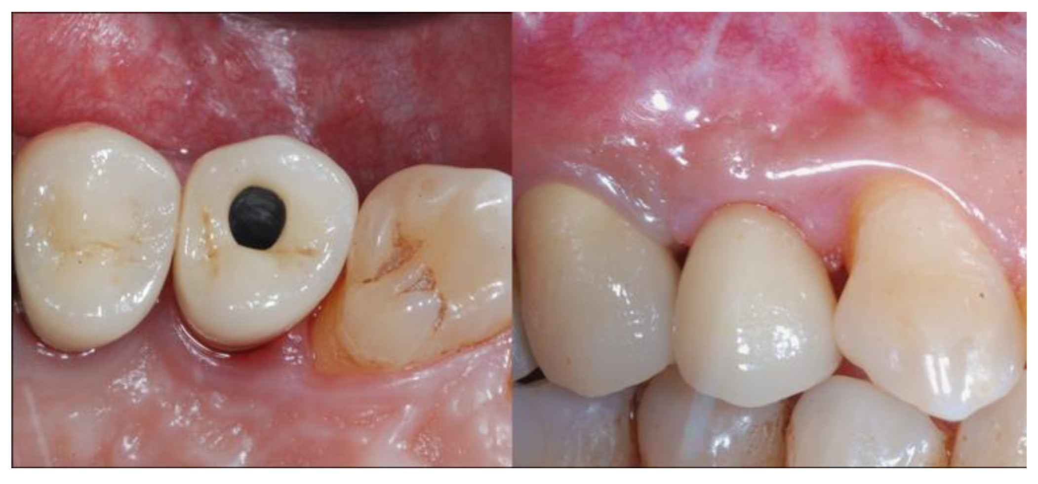 Materials 13 02389 g007