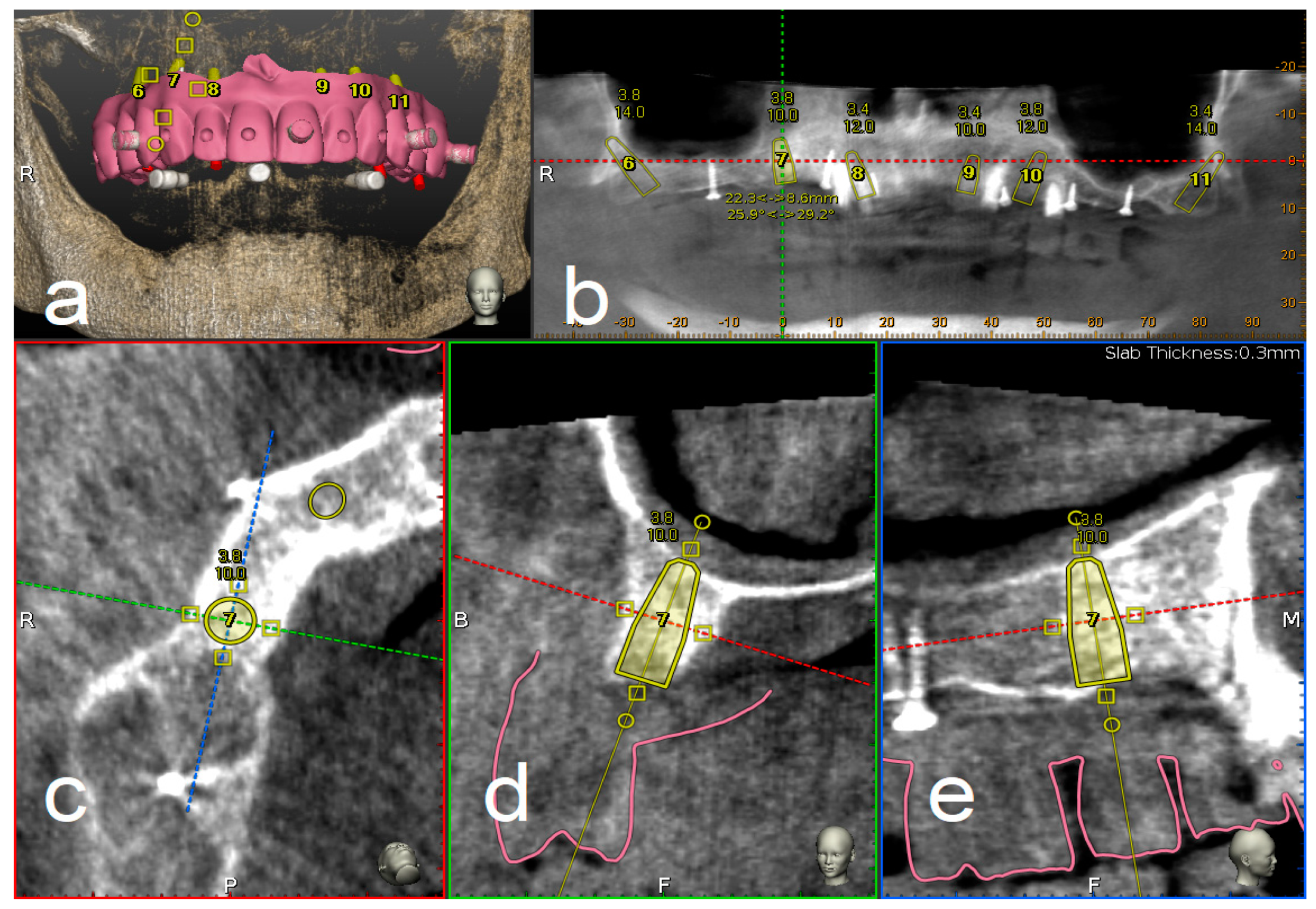 Materials 13 02806 g001