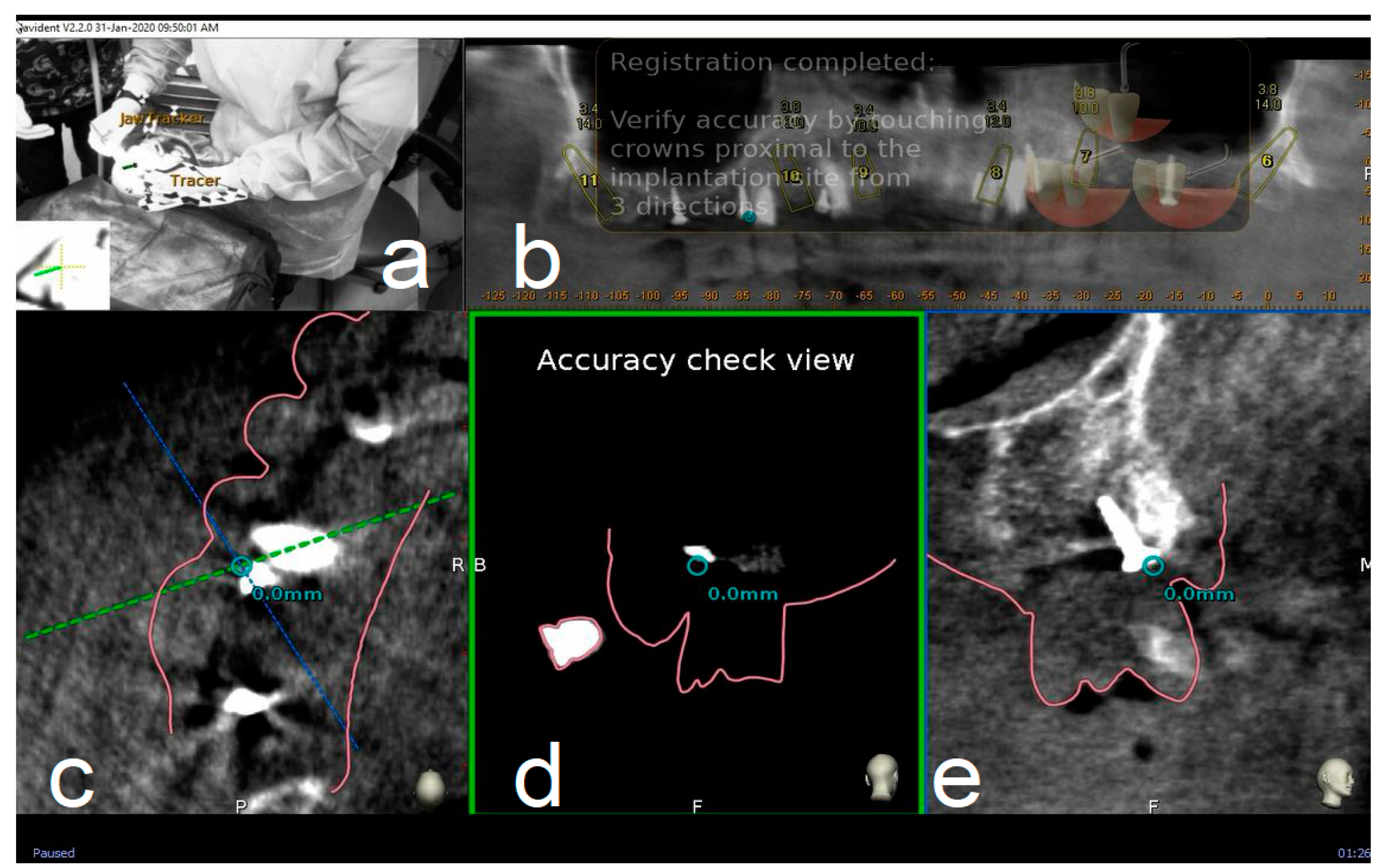 Materials 13 02806 g004
