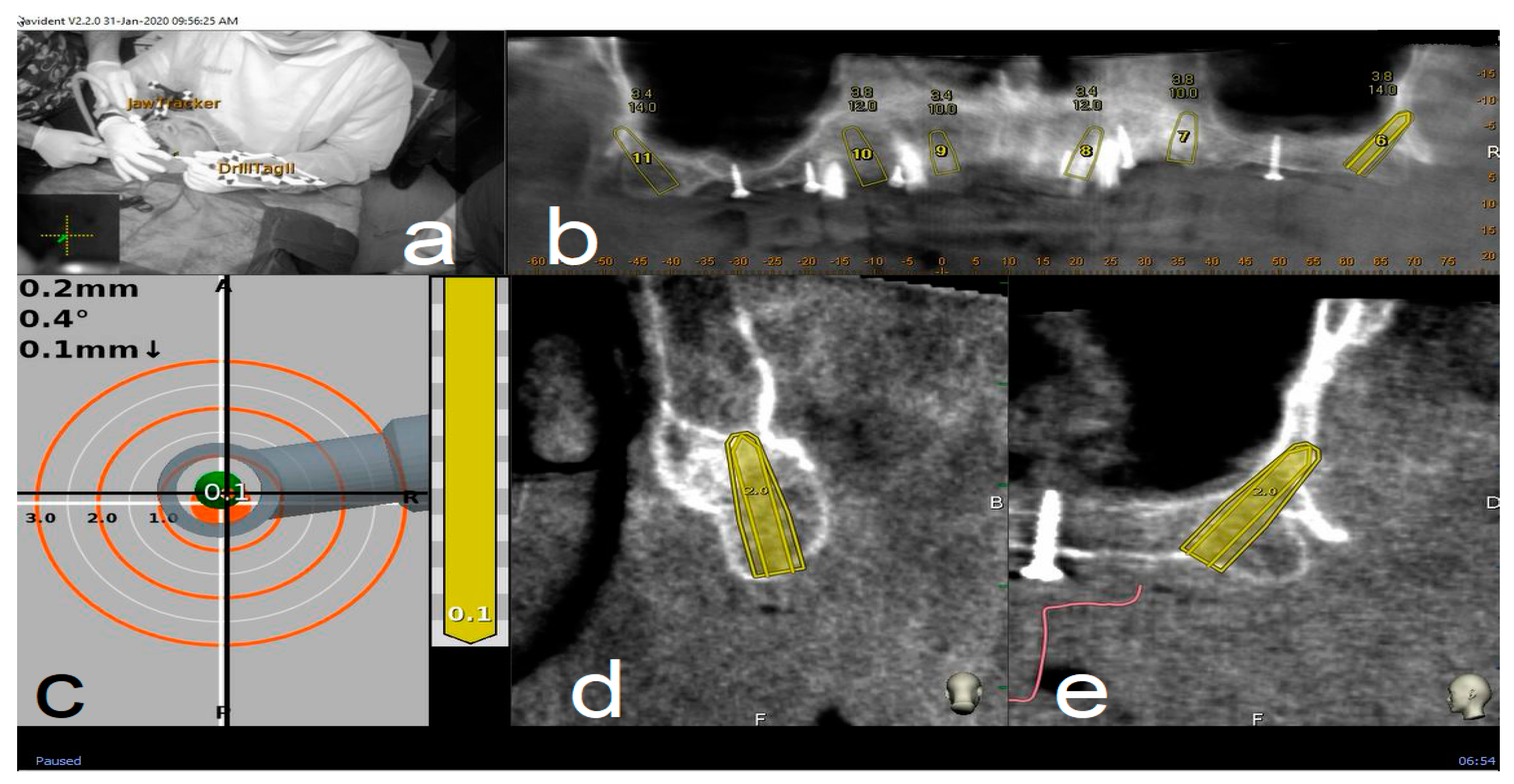Materials 13 02806 g005