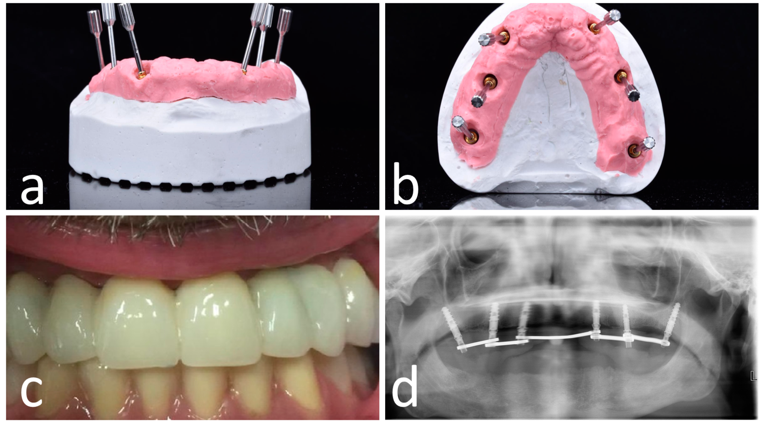 Materials 13 02806 g006