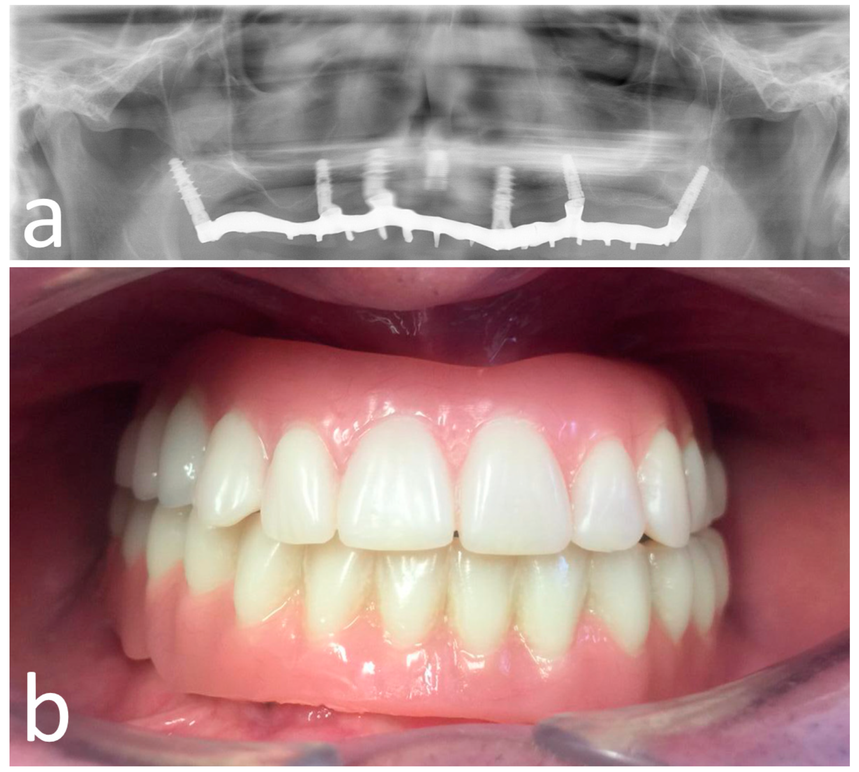 Materials 13 02806 g007