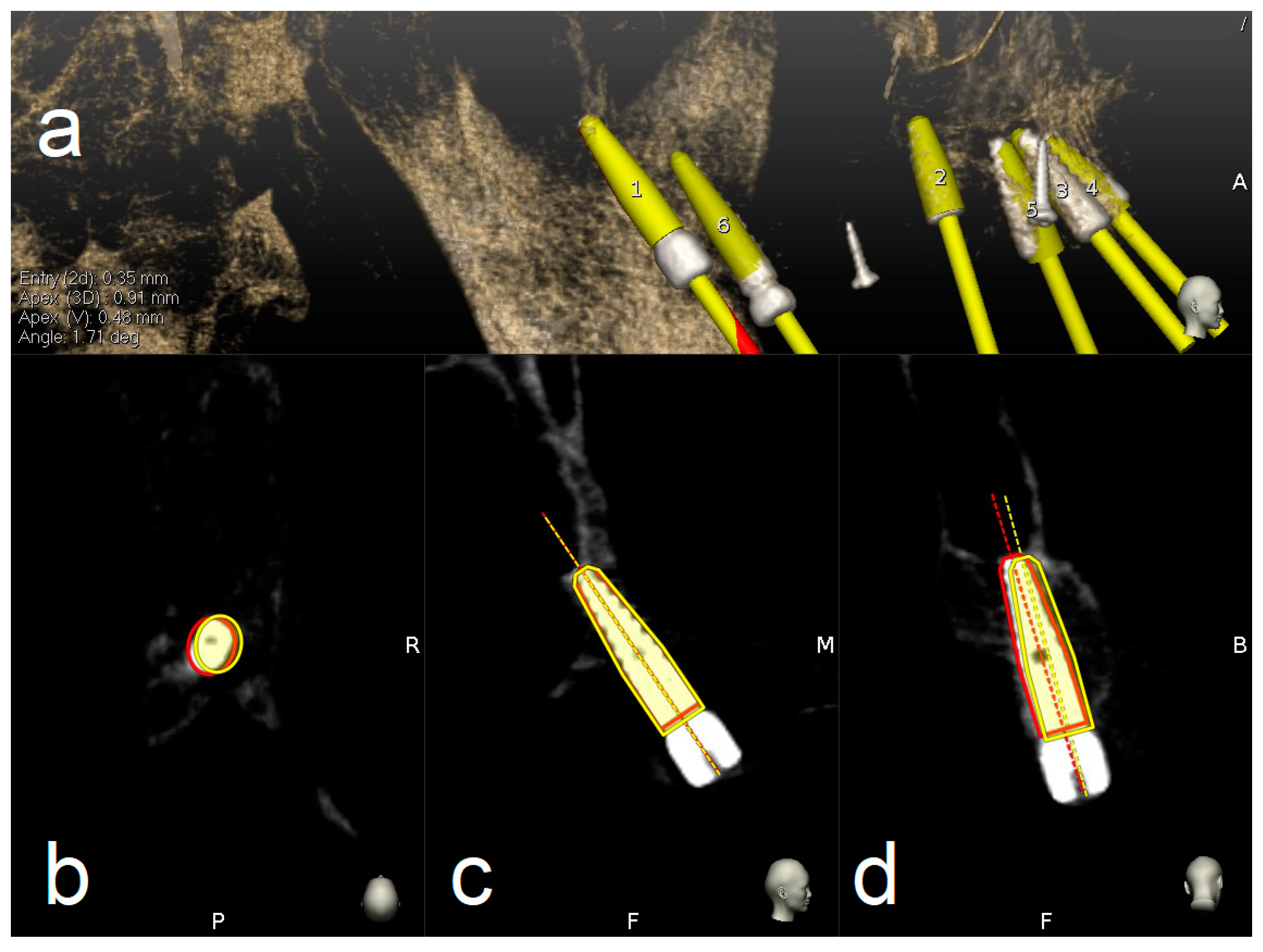 Materials 13 02806 g009