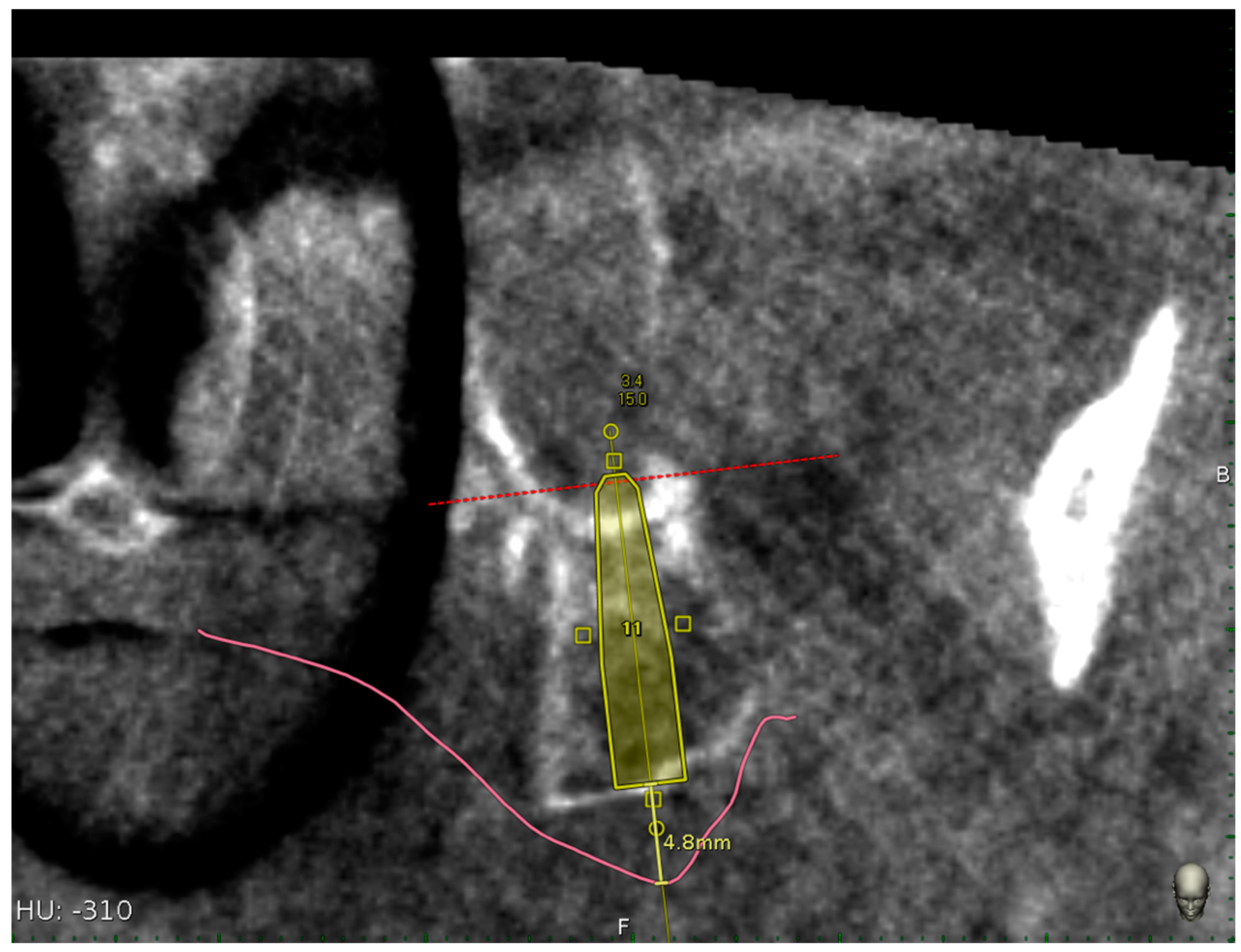 Materials 13 02806 g010