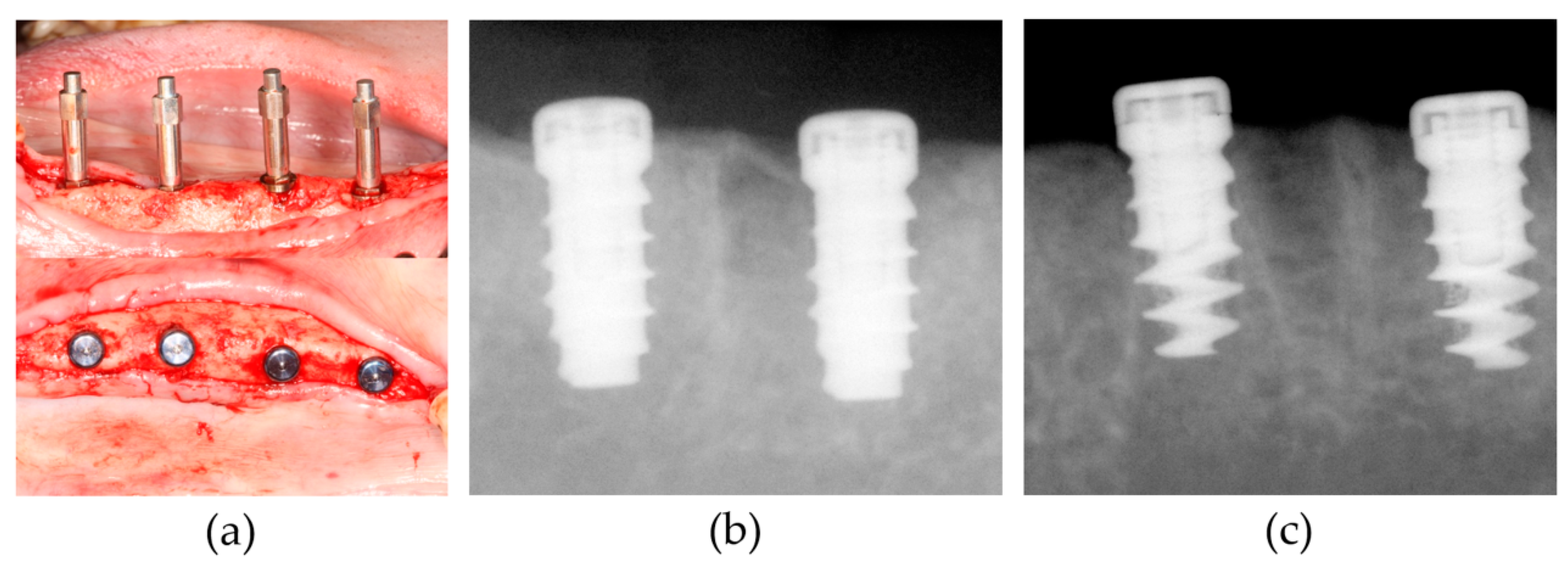 Materials 13 03061 g003