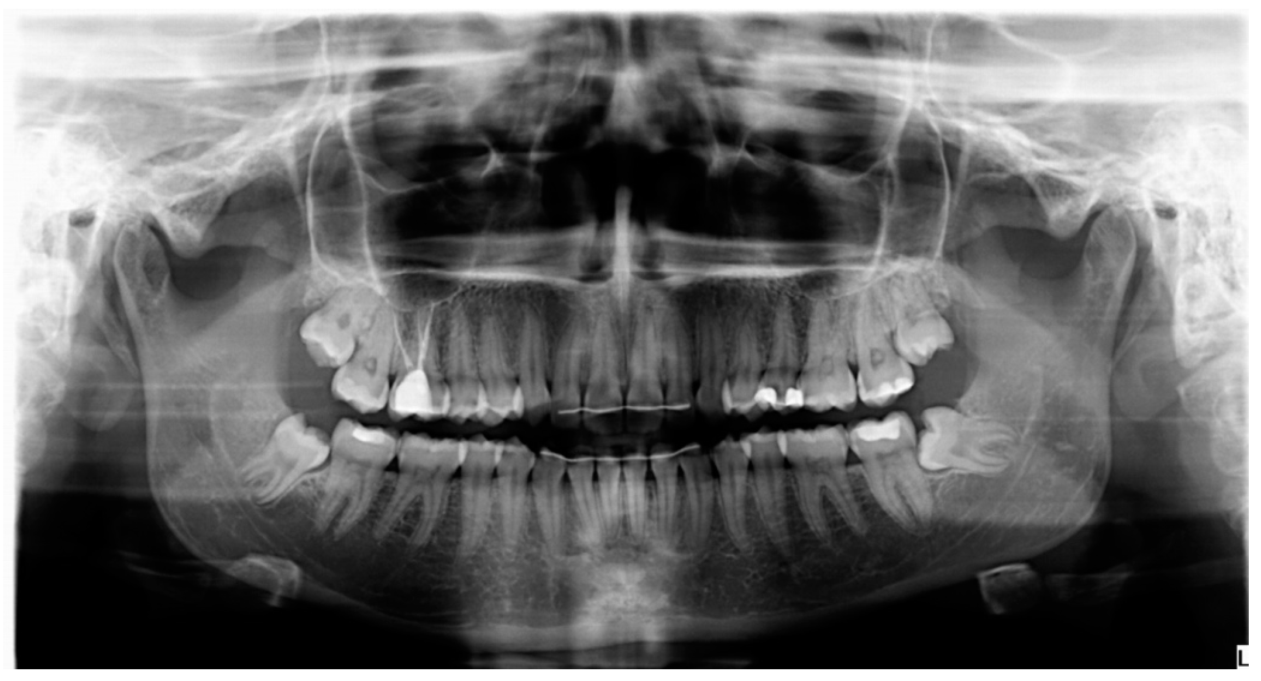 Materials 13 03090 g003