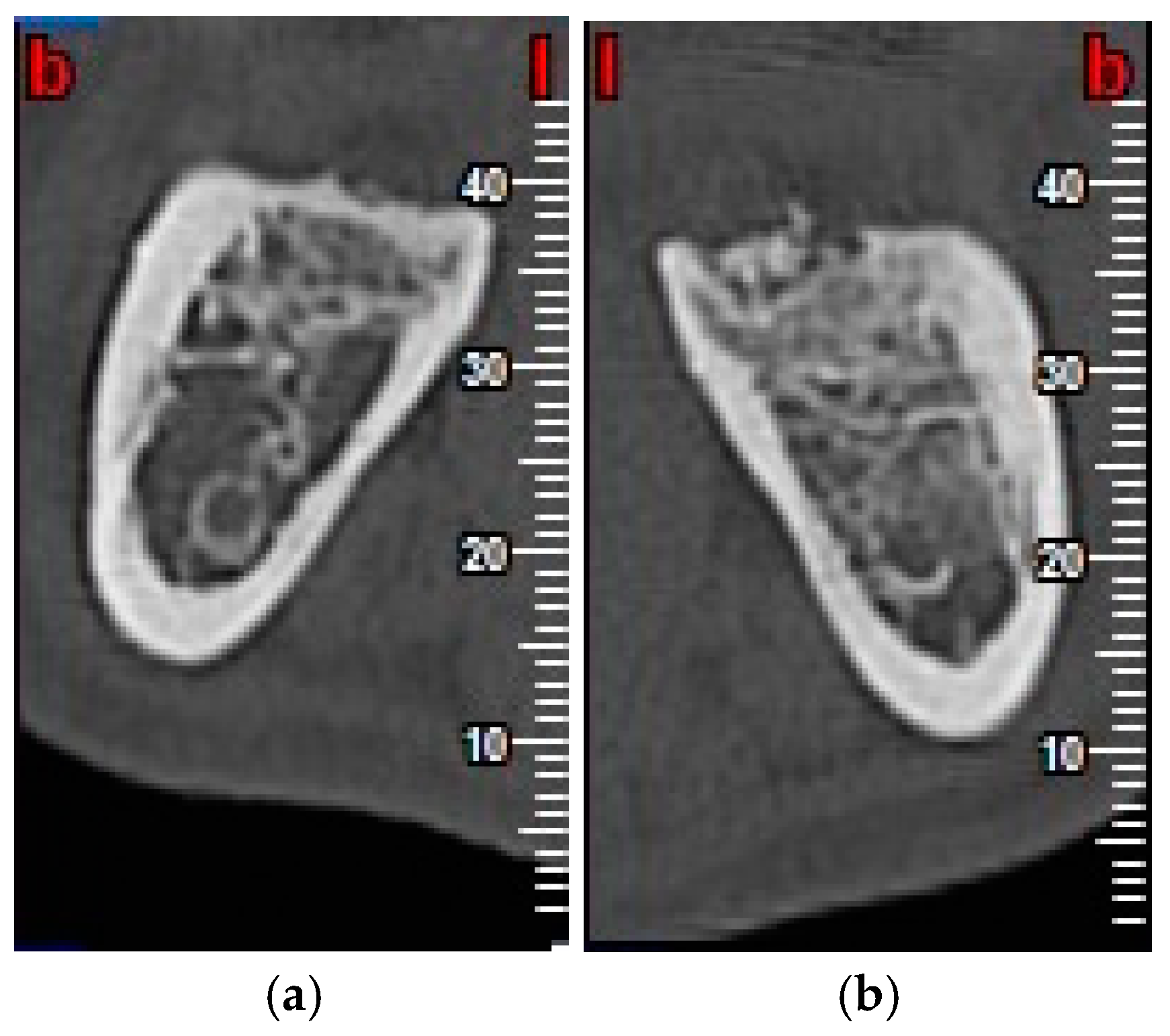 Materials 13 03090 g006