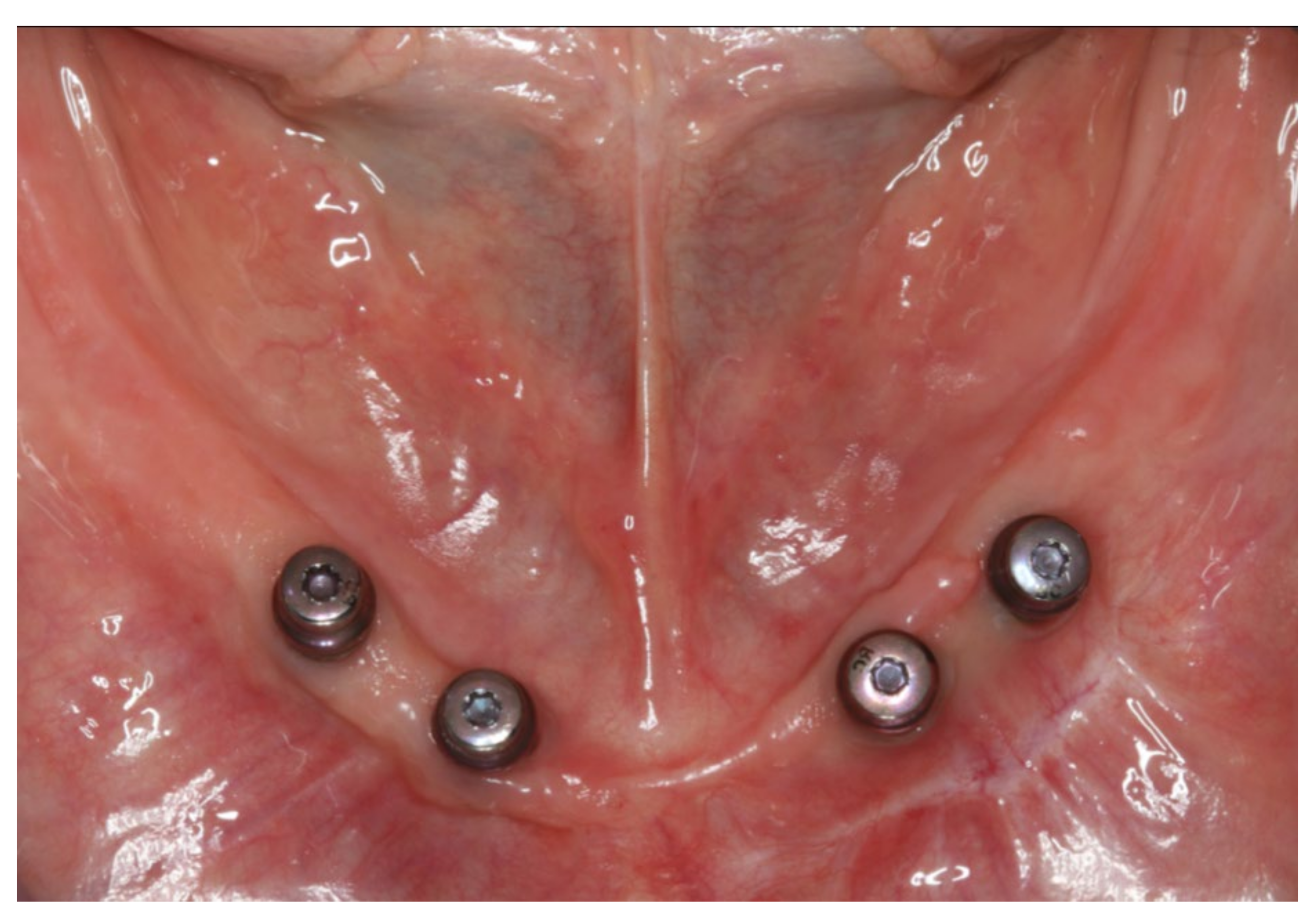 Materials 13 03688 g003 Materials 13 03688 g003