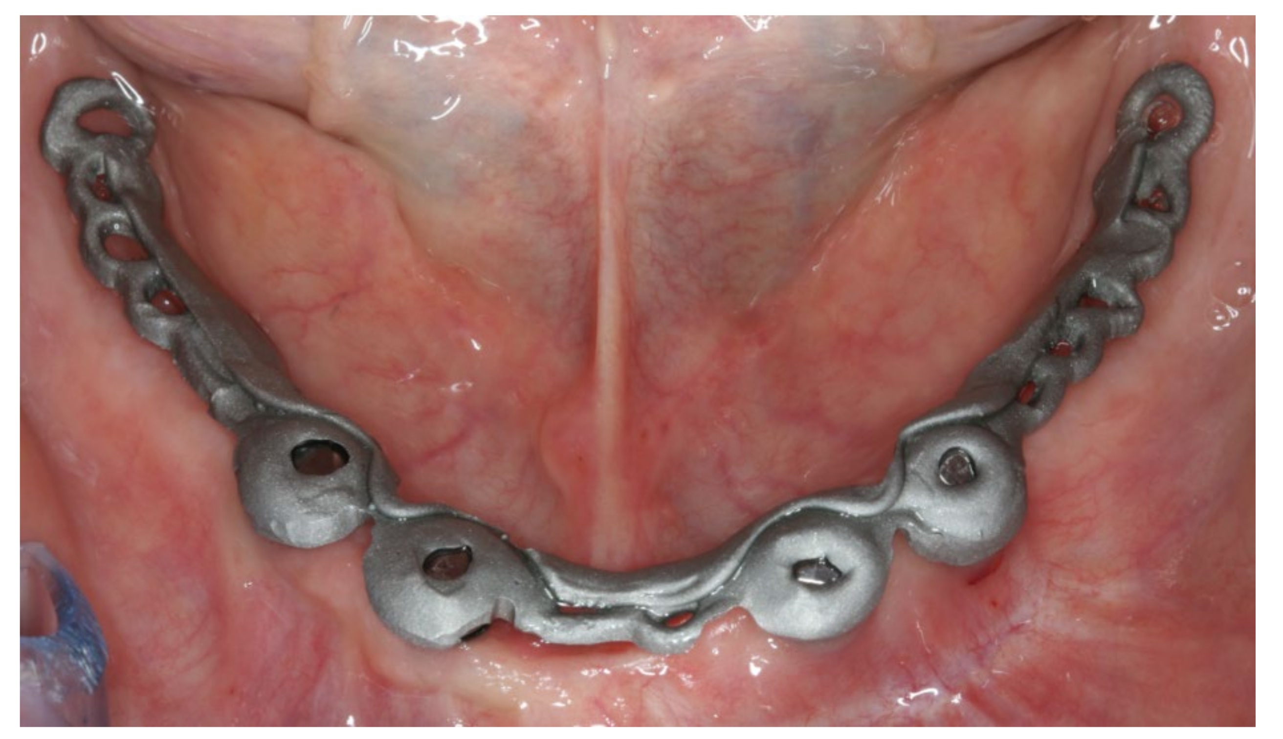 Materials 13 03688 g012 Materials 13 03688 g012