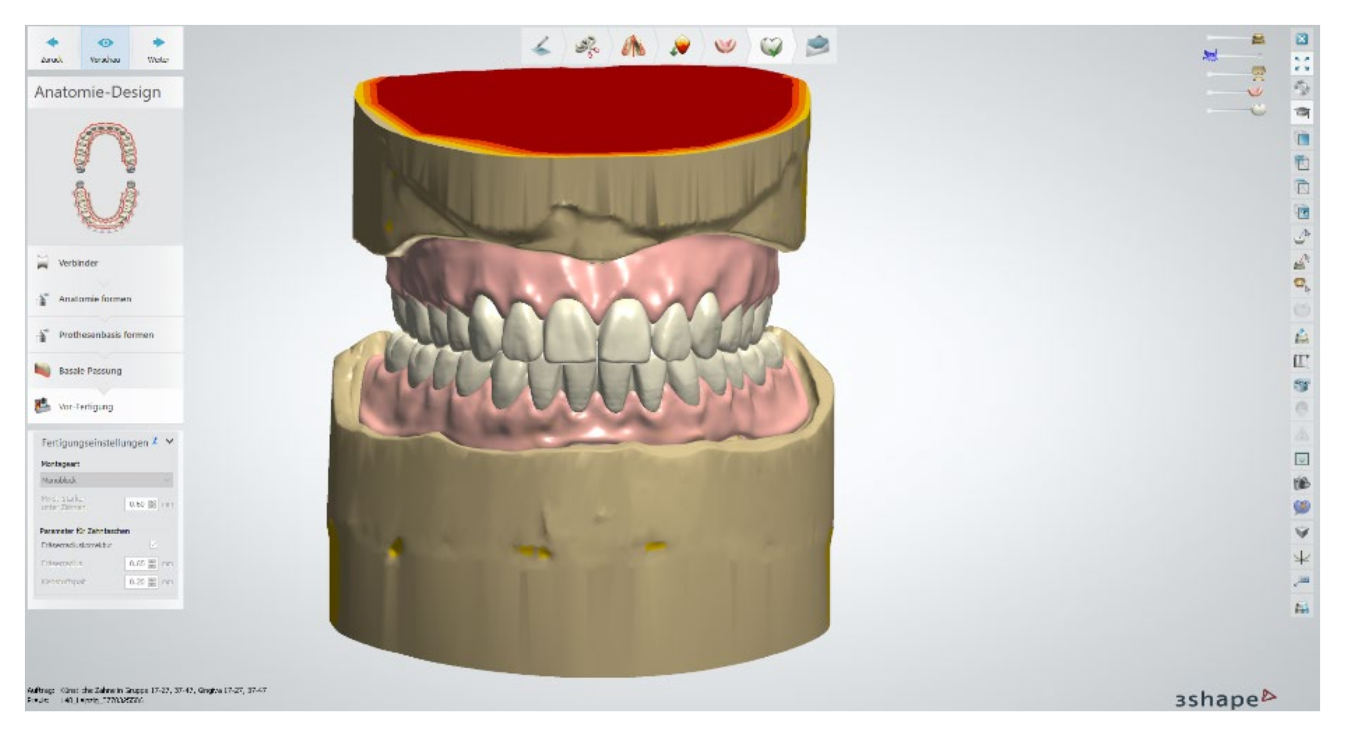 Materials 13 03688 g014 Materials 13 03688 g014
