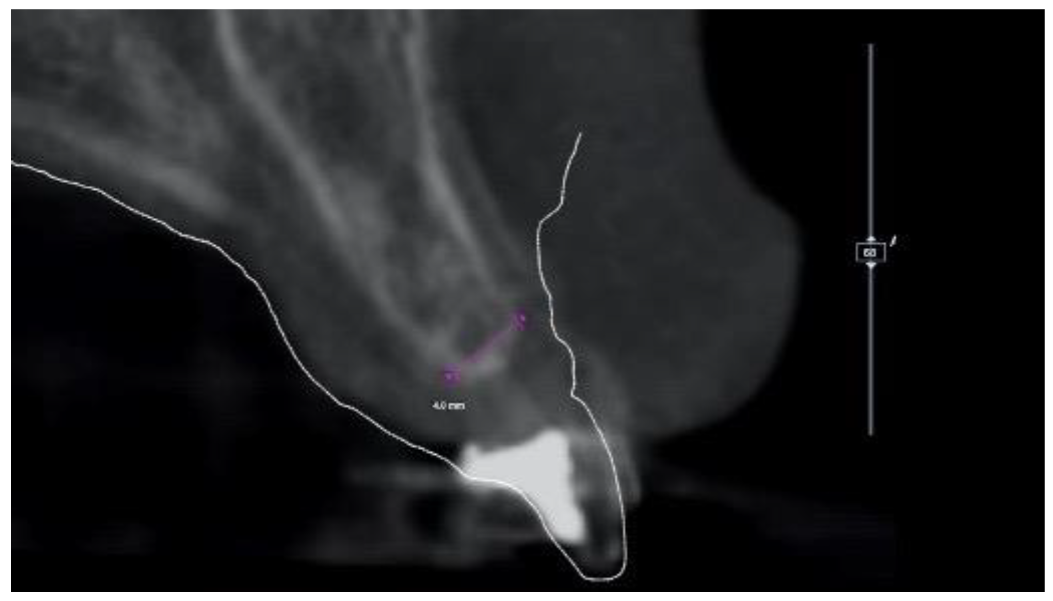 Materials 13 03874 g002 Materials 13 03874 g002