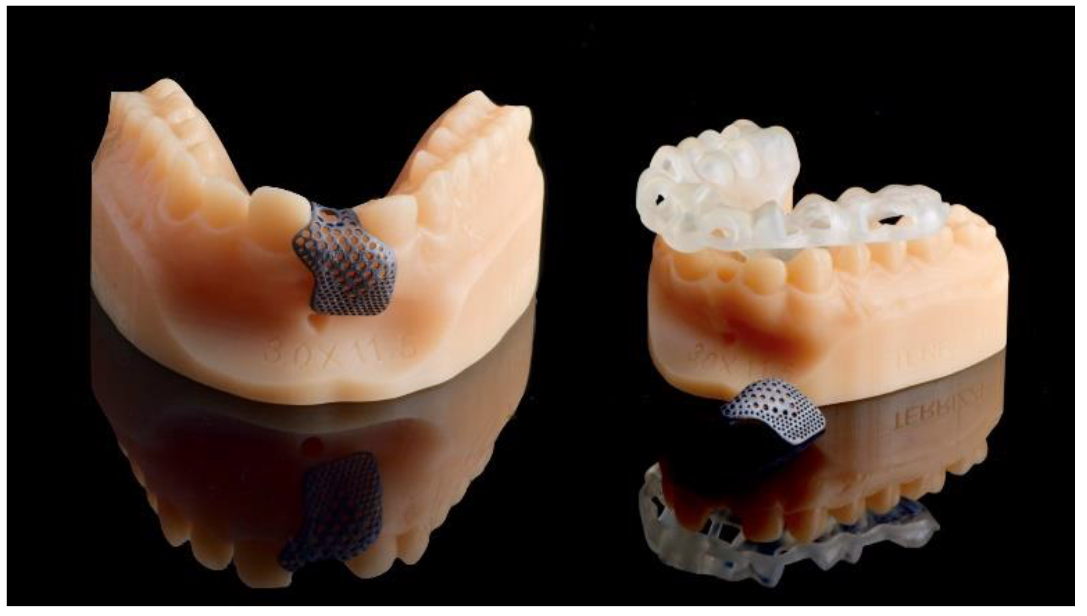 Materials 13 03874 g004 Materials 13 03874 g004