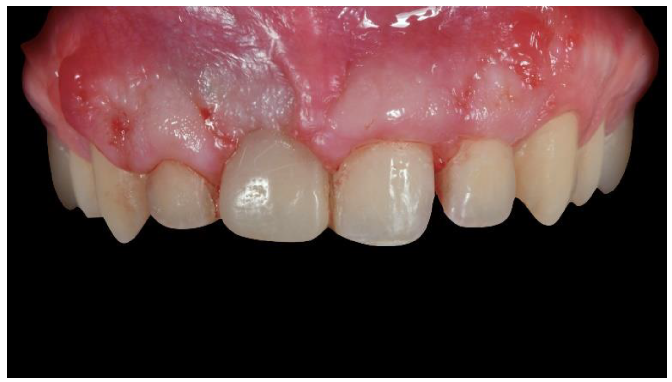 Materials 13 03874 g006 Materials 13 03874 g006