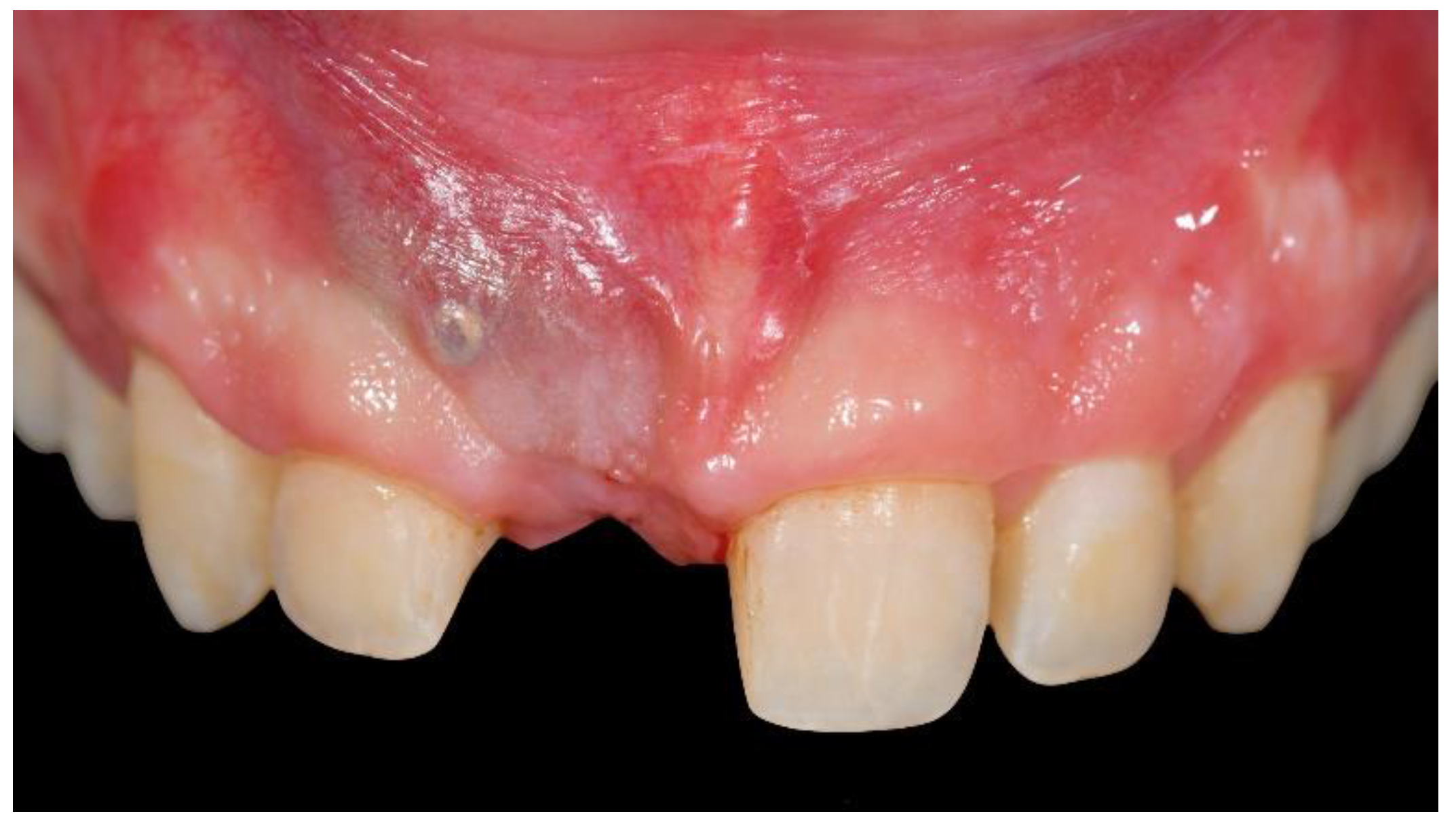 Materials 13 03874 g007 Materials 13 03874 g007