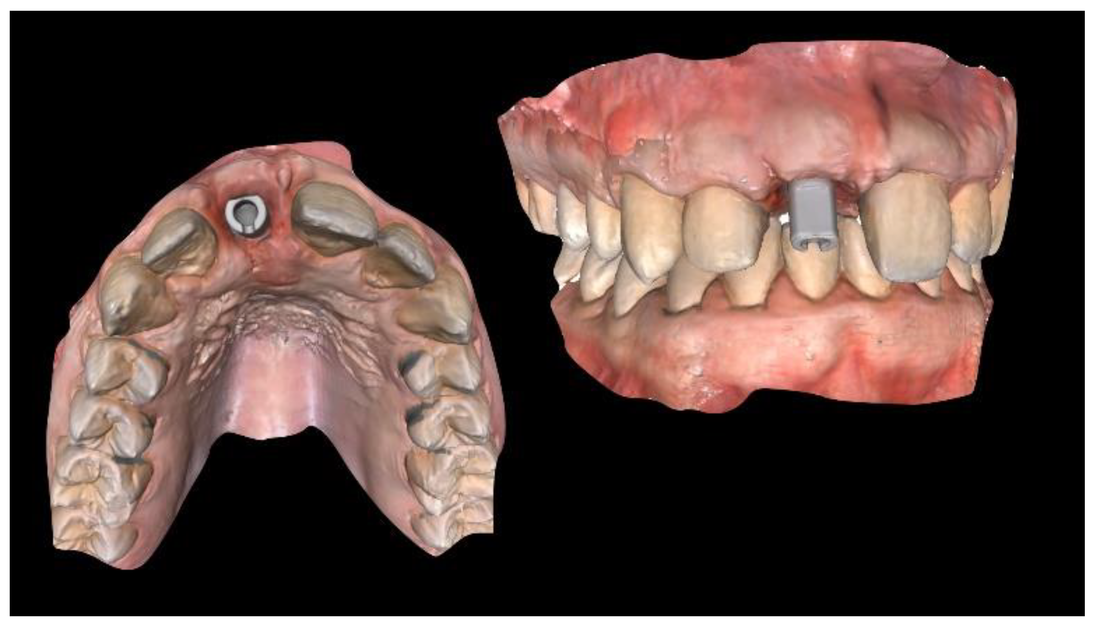 Materials 13 03874 g011 Materials 13 03874 g011