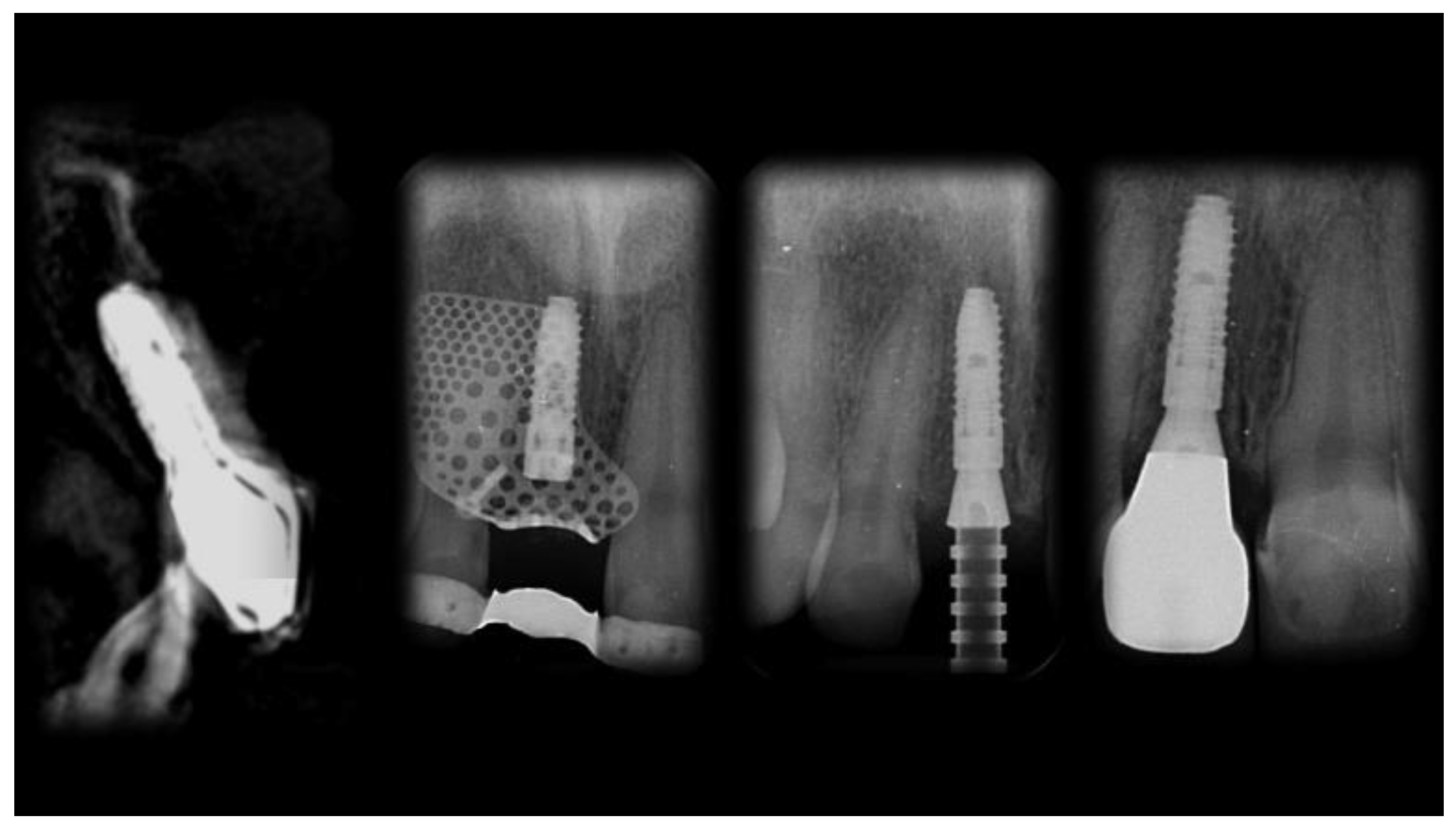 Materials 13 03874 g017 Materials 13 03874 g017