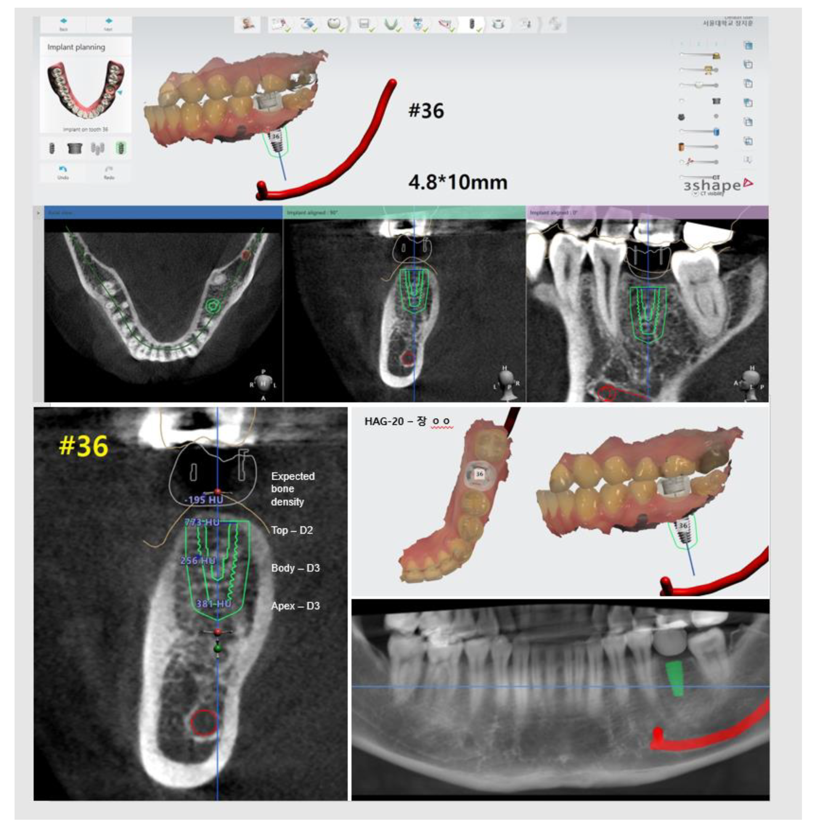 Materials 13 03912 g002 Materials 13 03912 g002
