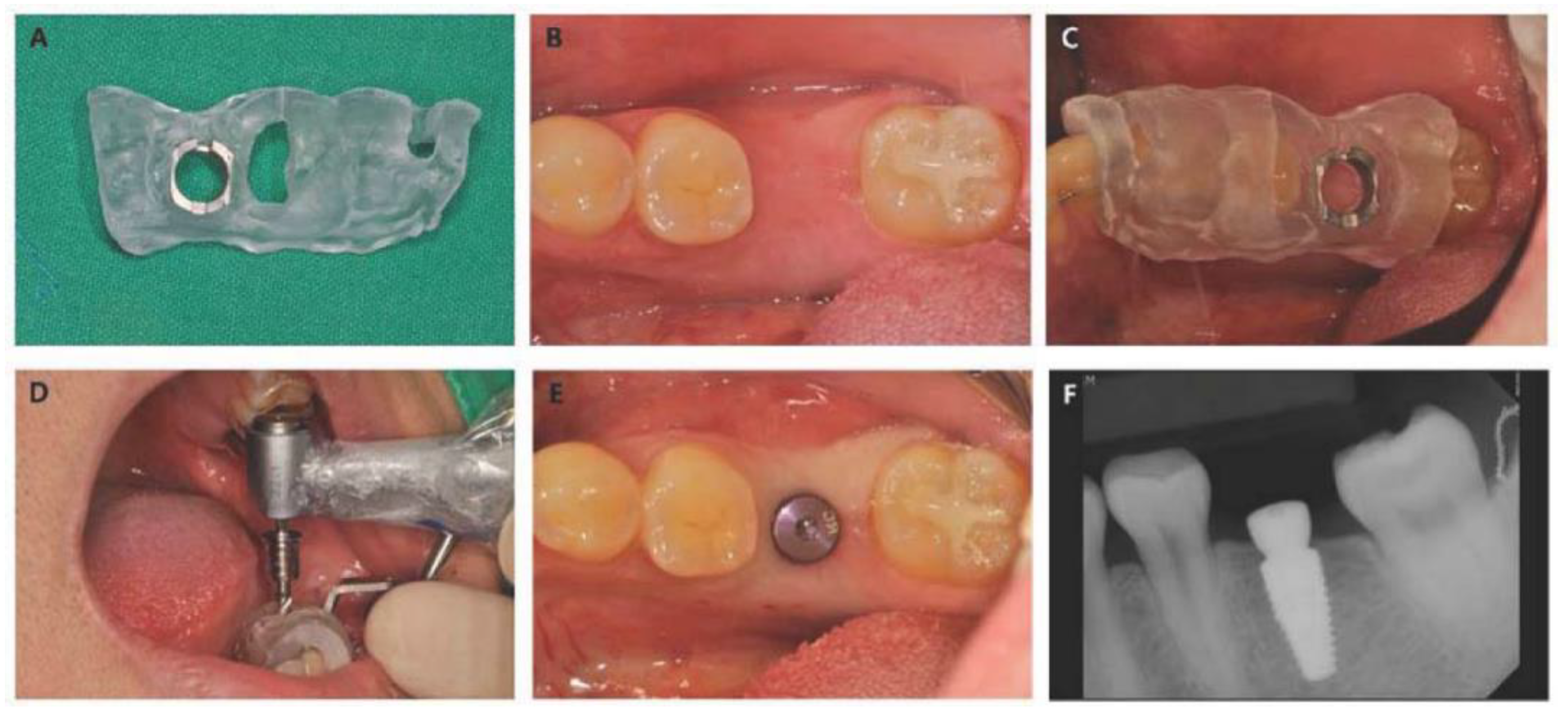 Materials 13 03912 g003 Materials 13 03912 g003