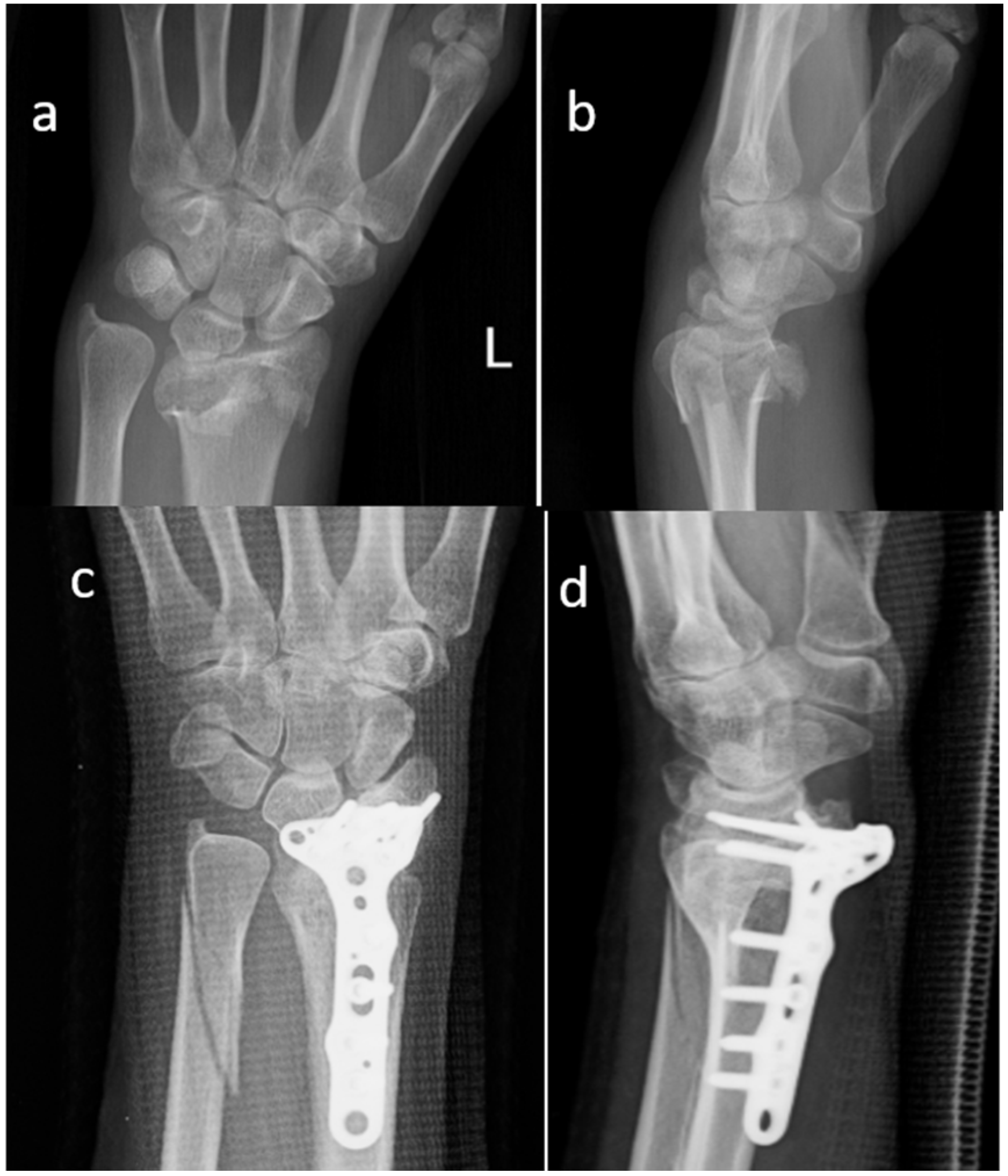 Materials 13 04040 g001 Materials 13 04040 g001