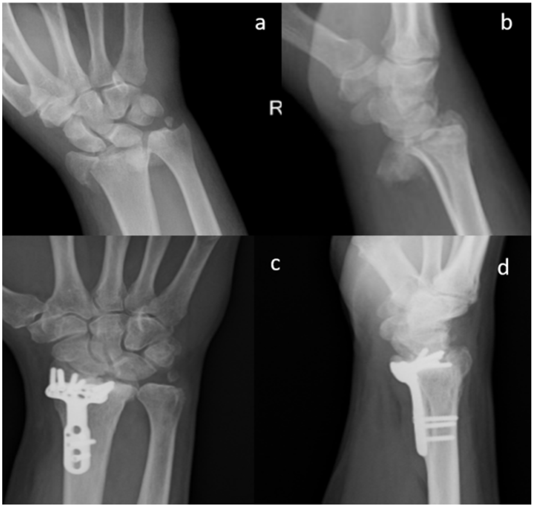 Materials 13 04040 g002 Materials 13 04040 g002