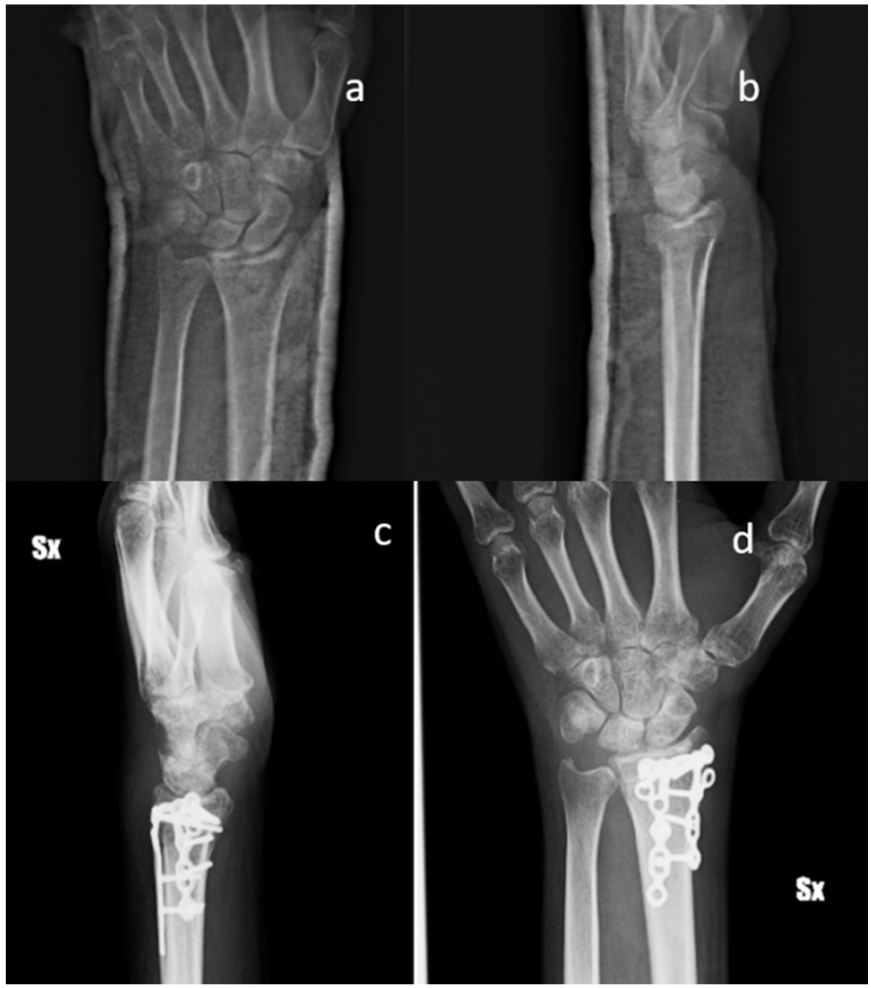 Materials 13 04040 g003 Materials 13 04040 g003