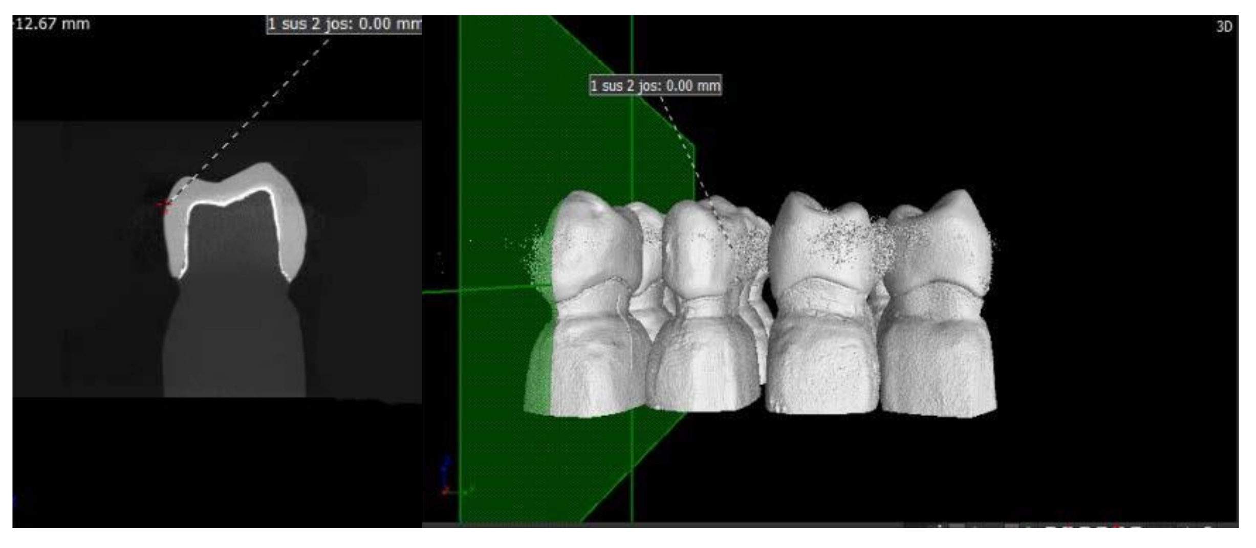Materials 13 04239 g005 Materials 13 04239 g005