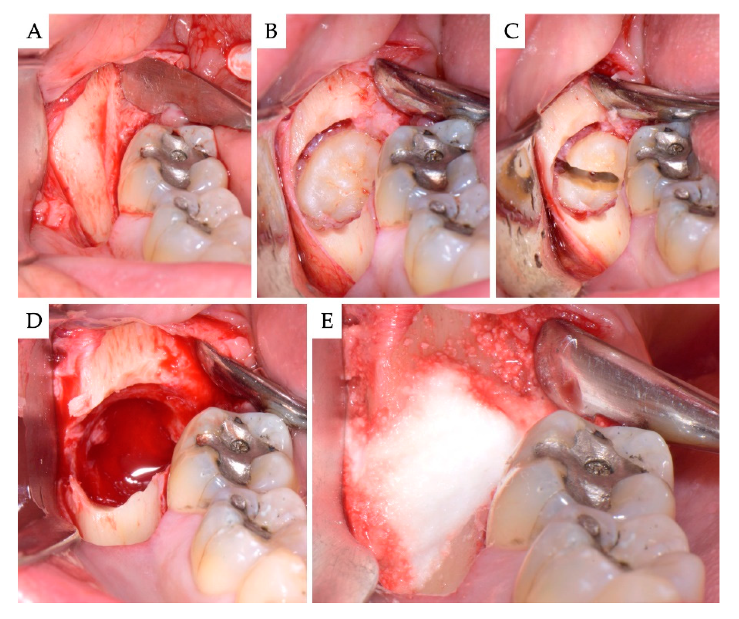 Materials 13 04688 g002