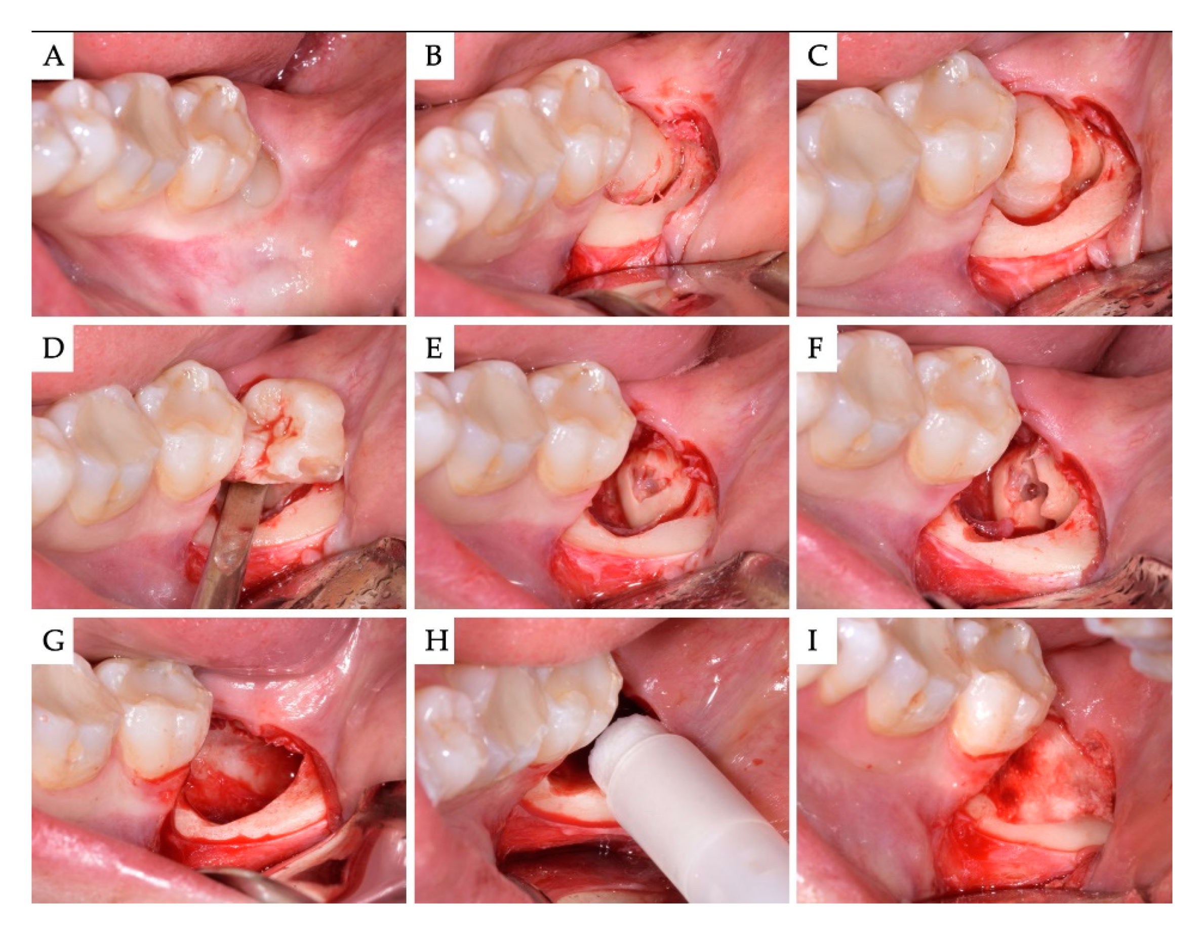 Materials 13 04688 g003