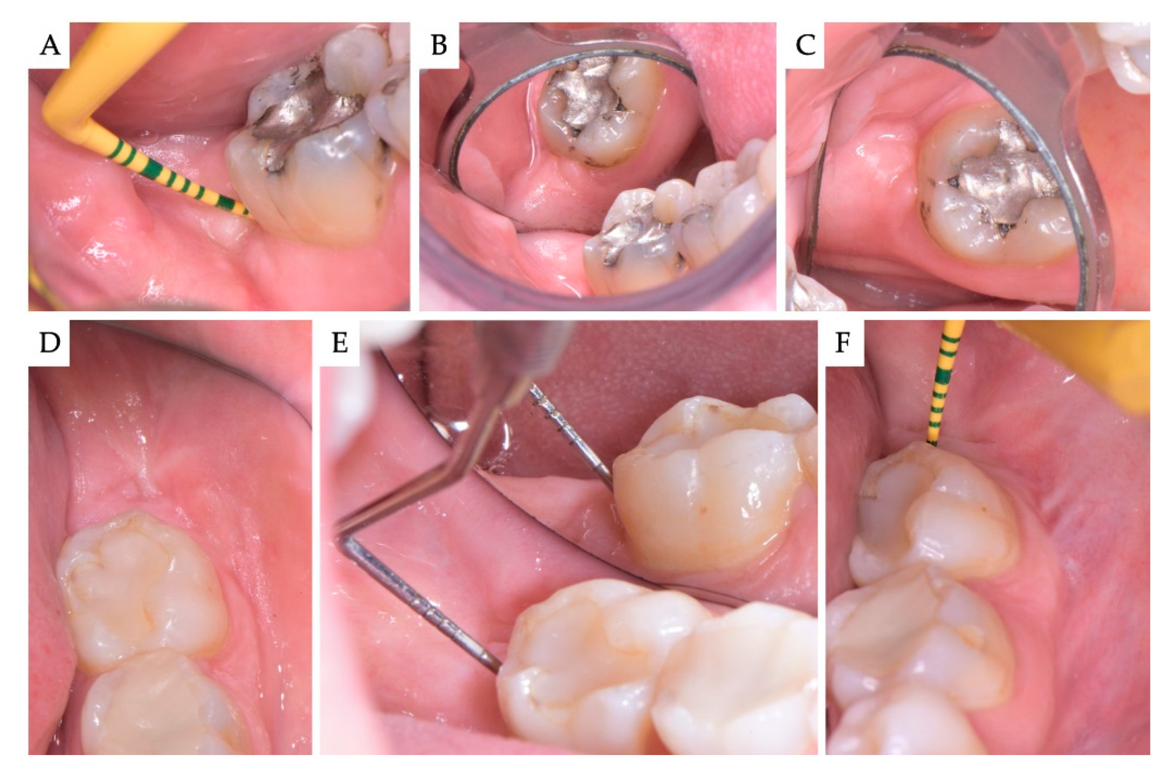Materials 13 04688 g004