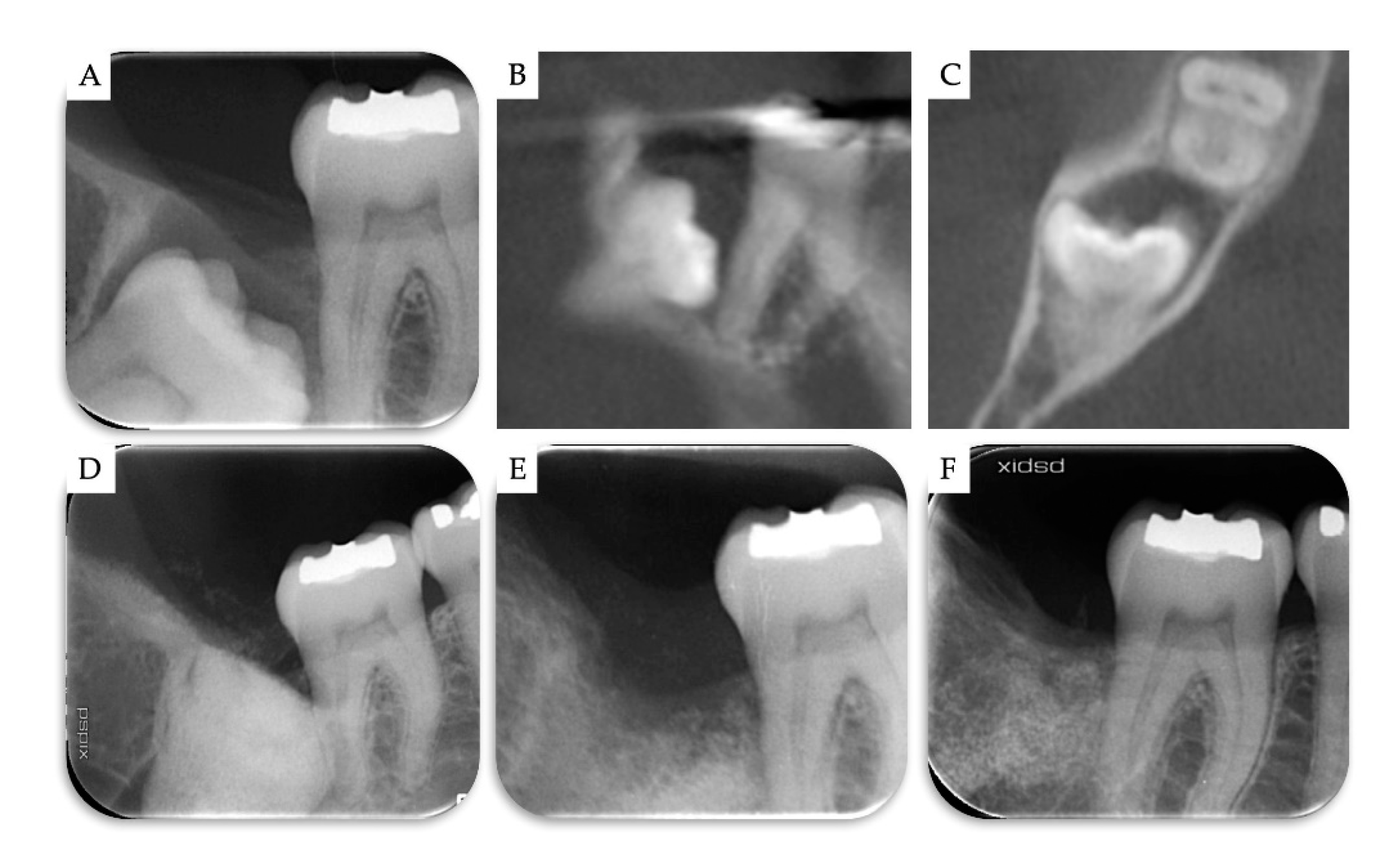 Materials 13 04688 g005