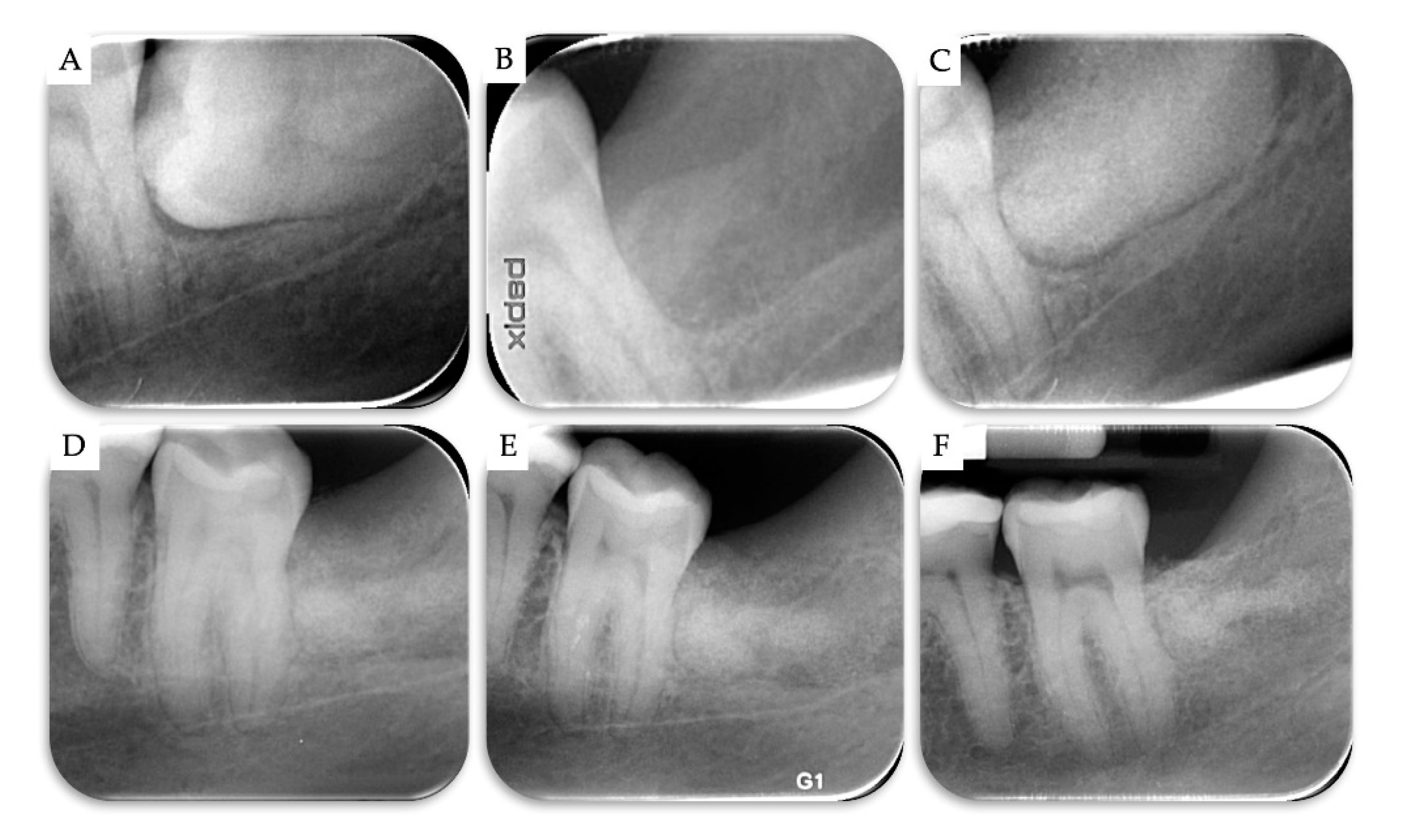 Materials 13 04688 g006