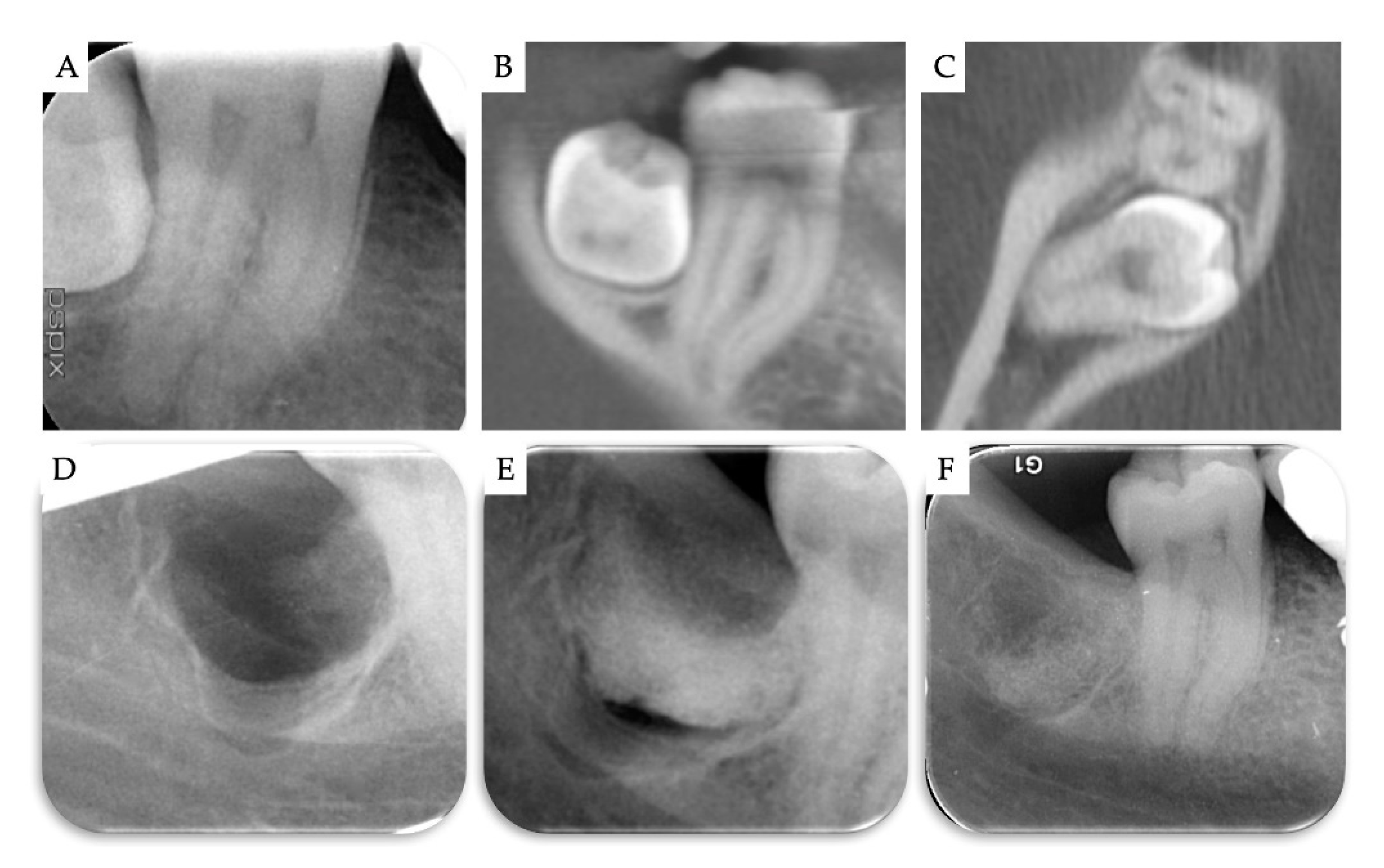 Materials 13 04688 g008