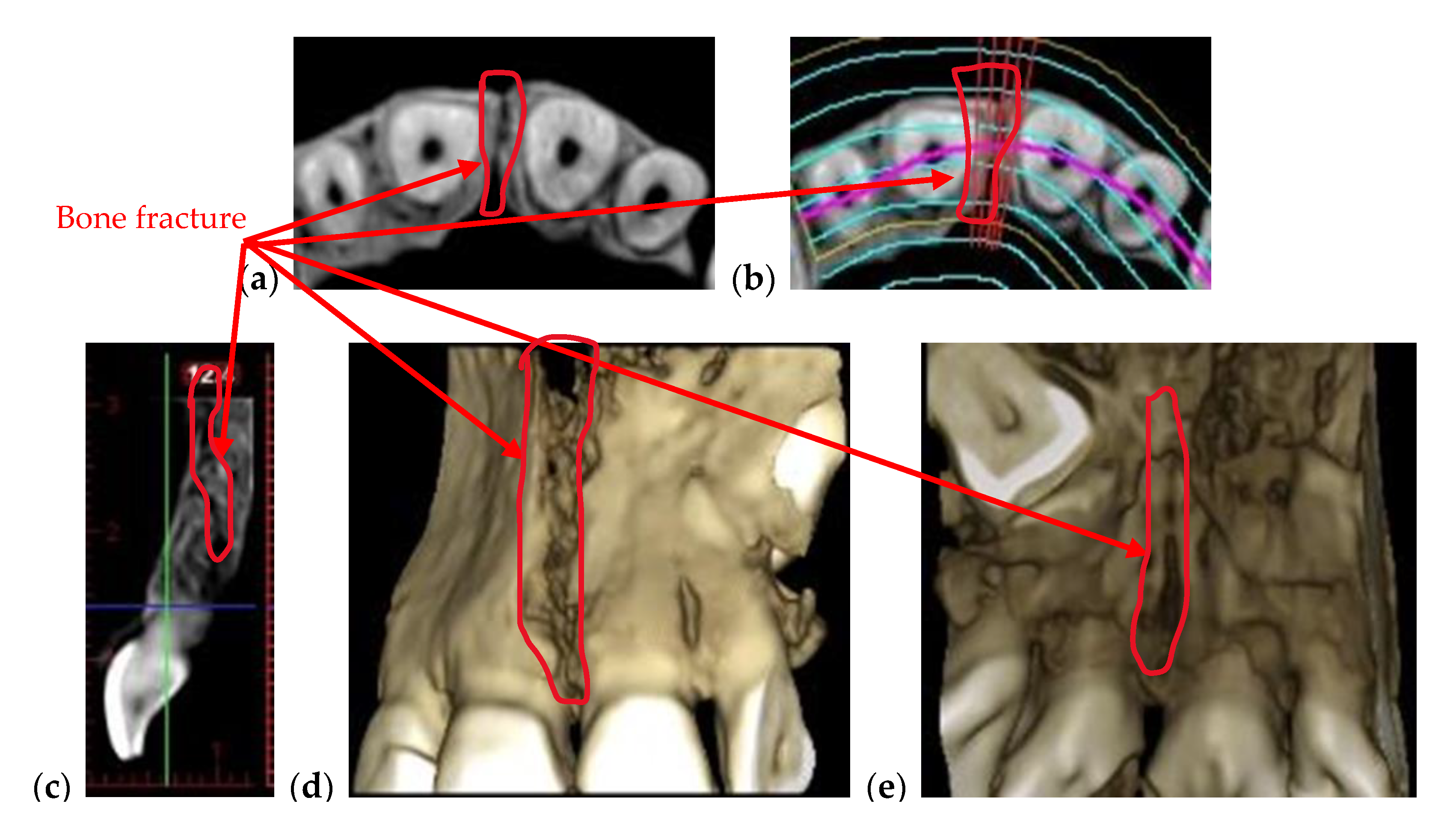 Materials 13 04825 g003