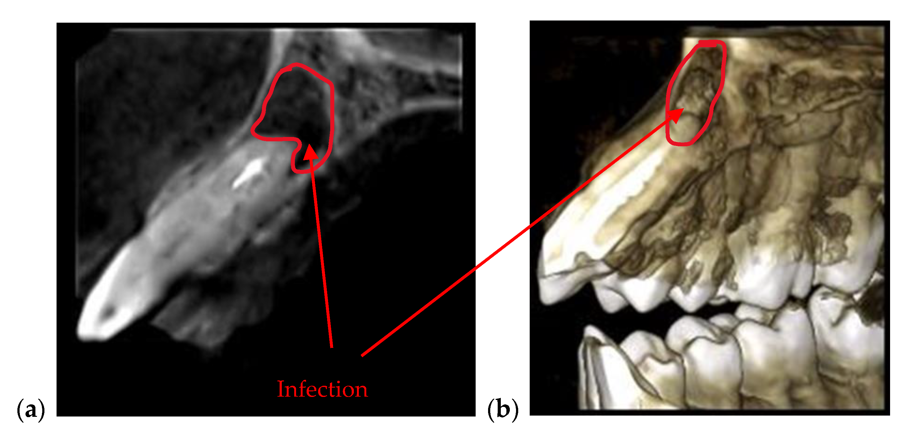 Materials 13 04825 g004