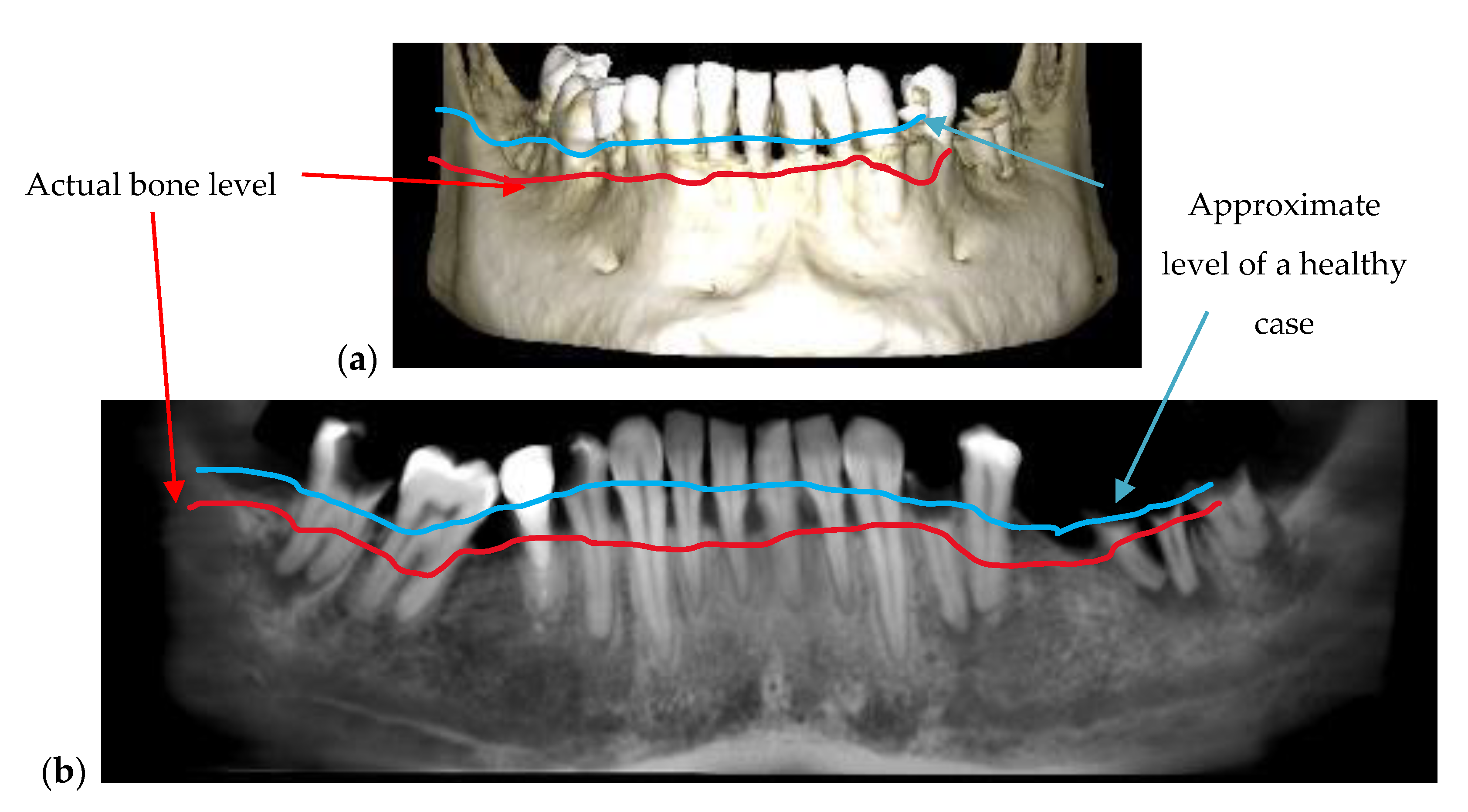 Materials 13 04825 g005