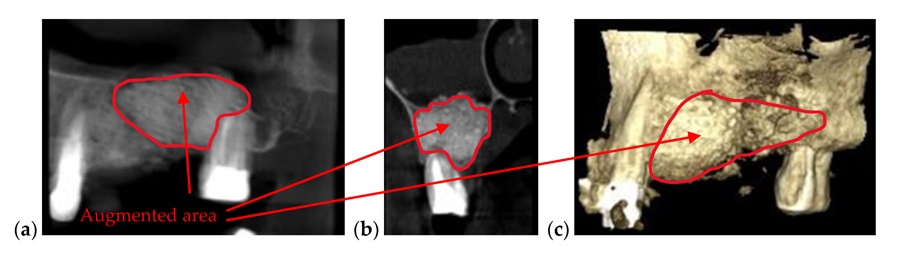 Materials 13 04825 g006