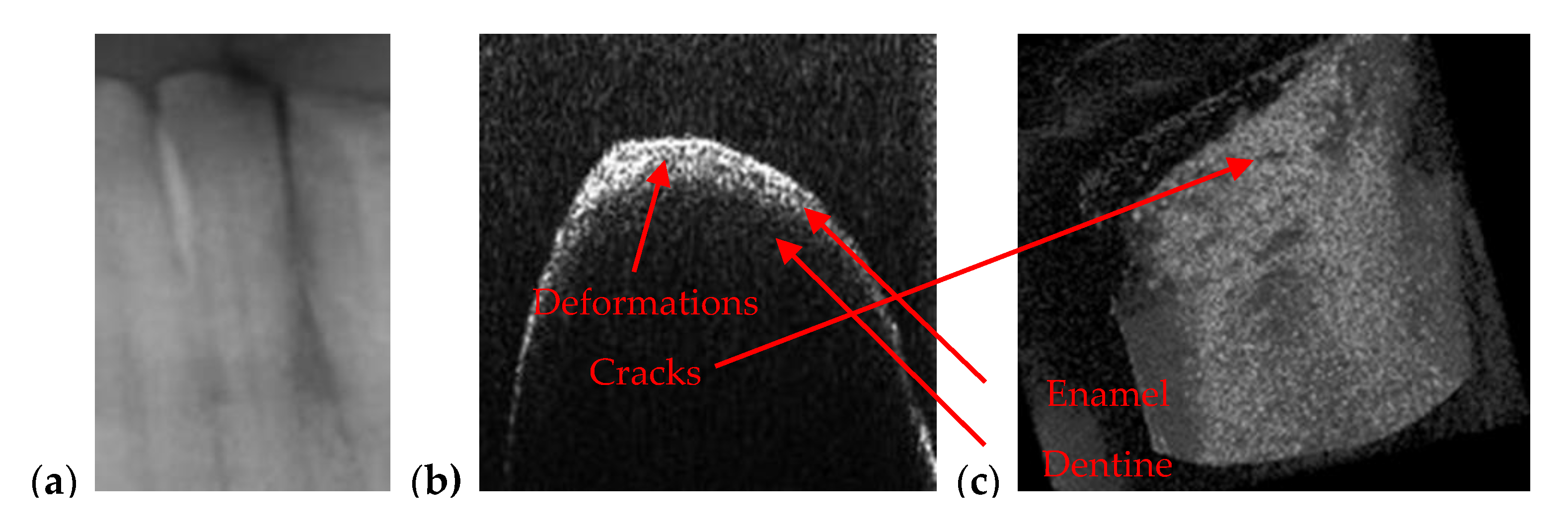 Materials 13 04825 g011