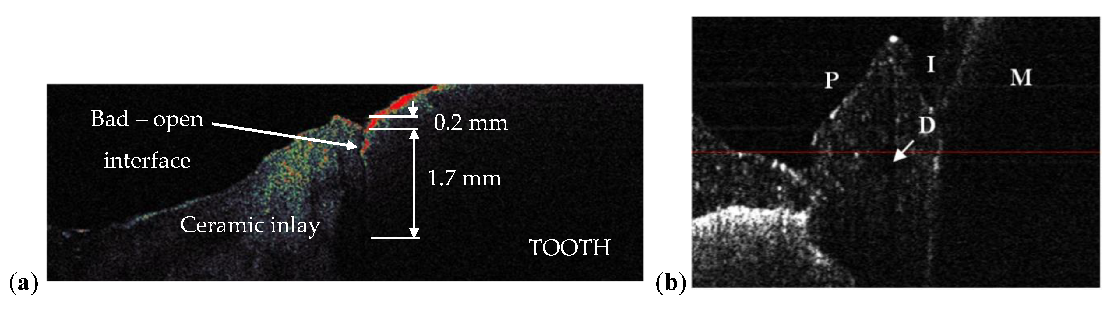 Materials 13 04825 g018