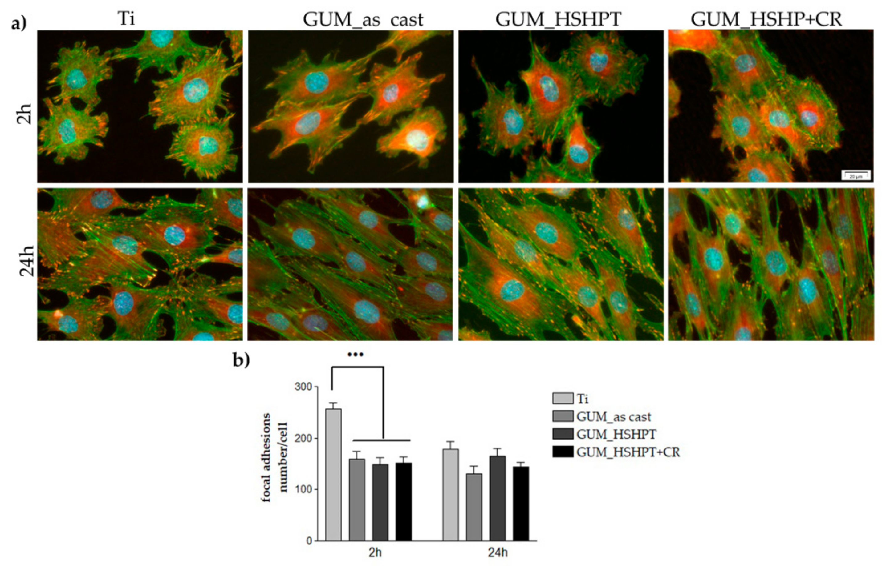 Materials 13 04853 g005