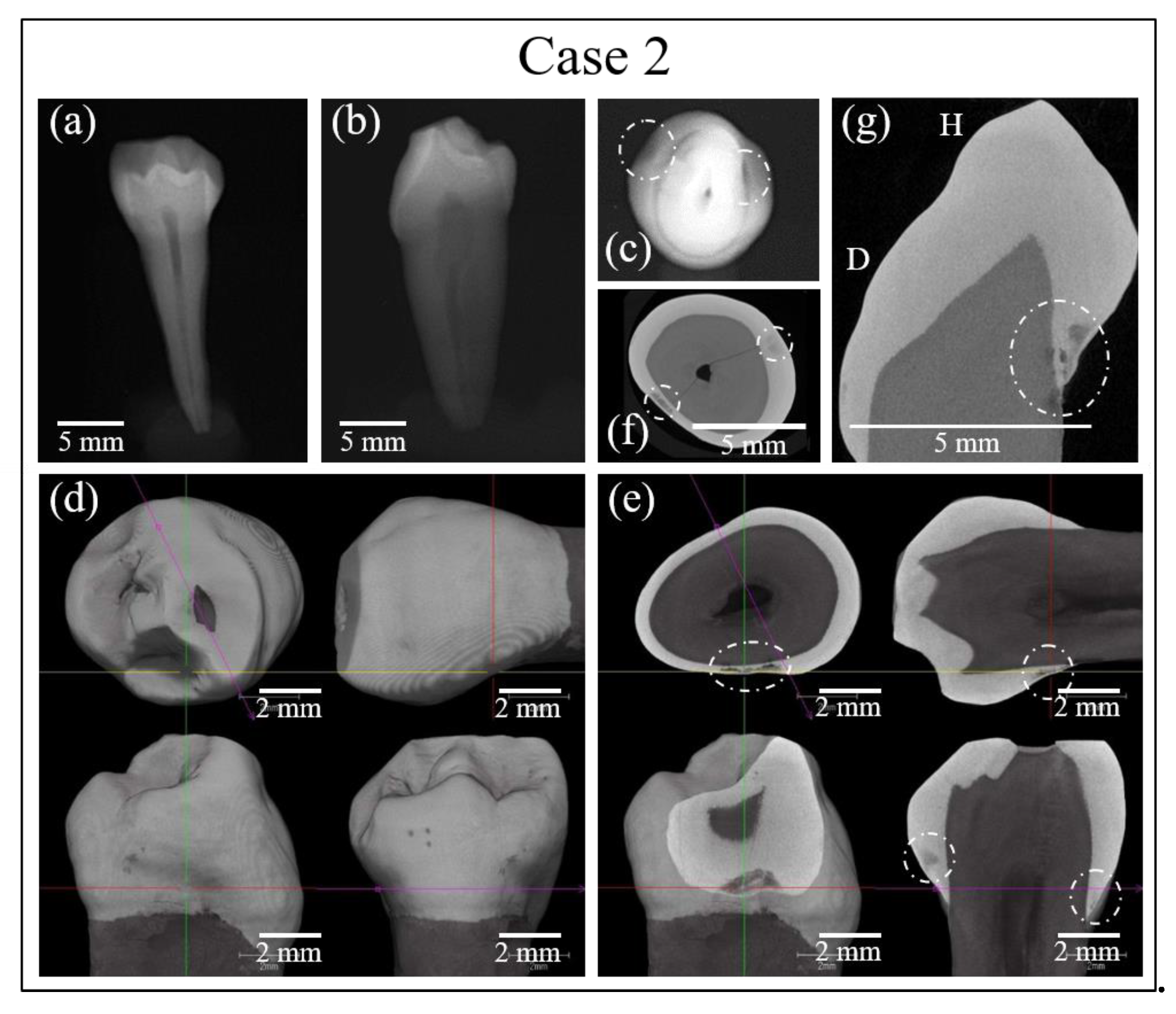 Materials 13 04900 g005