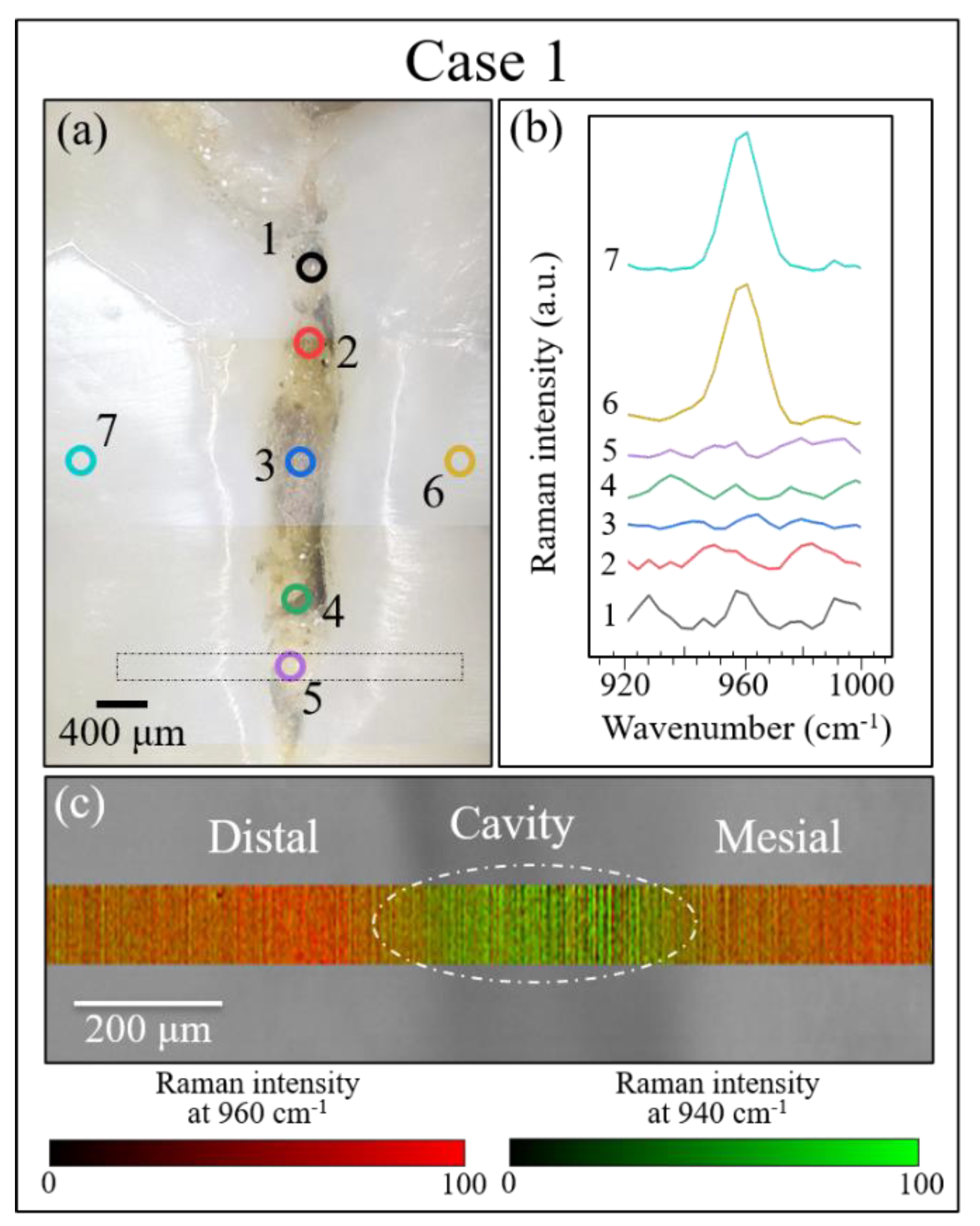 Materials 13 04900 g008