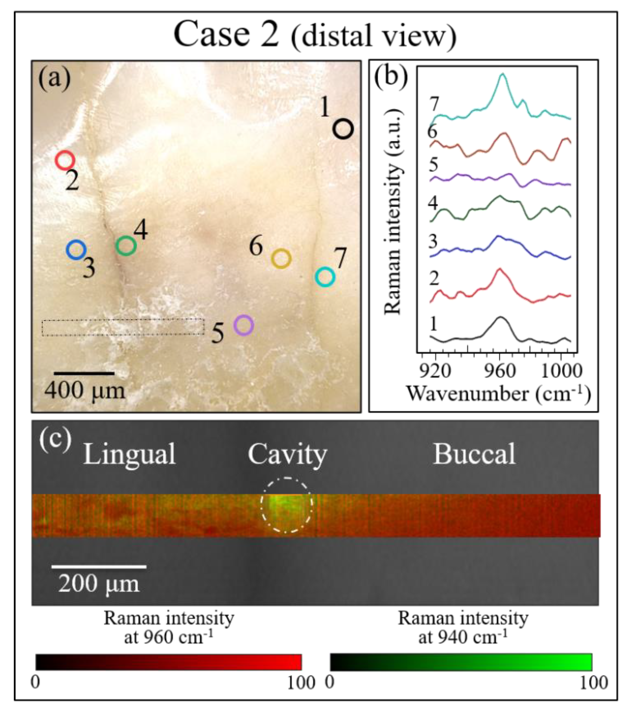 Materials 13 04900 g009