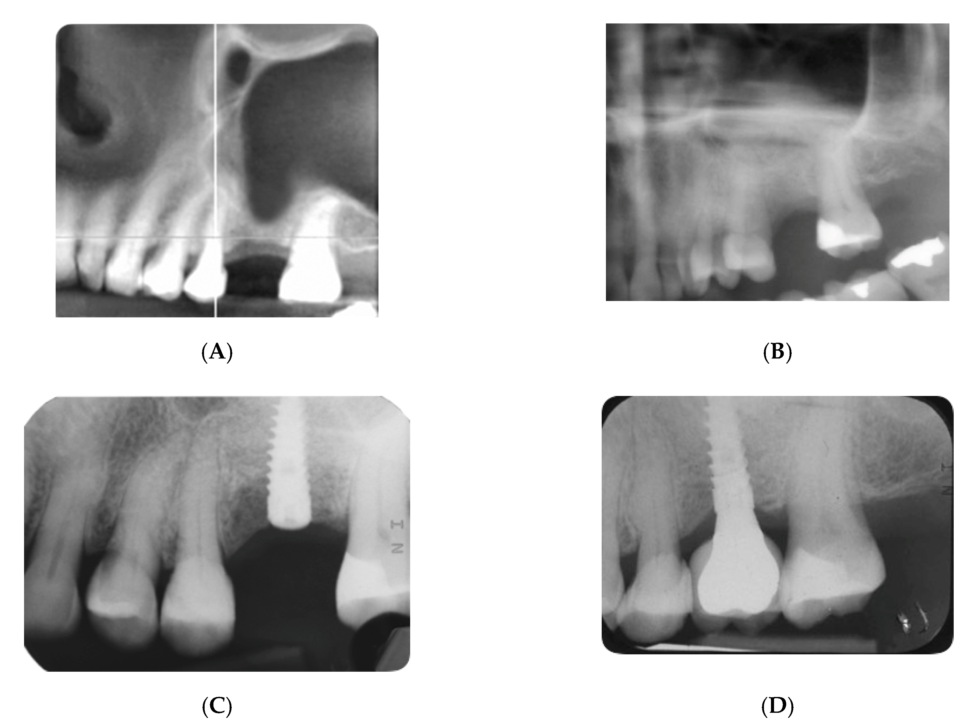 Materials 13 05093 g001