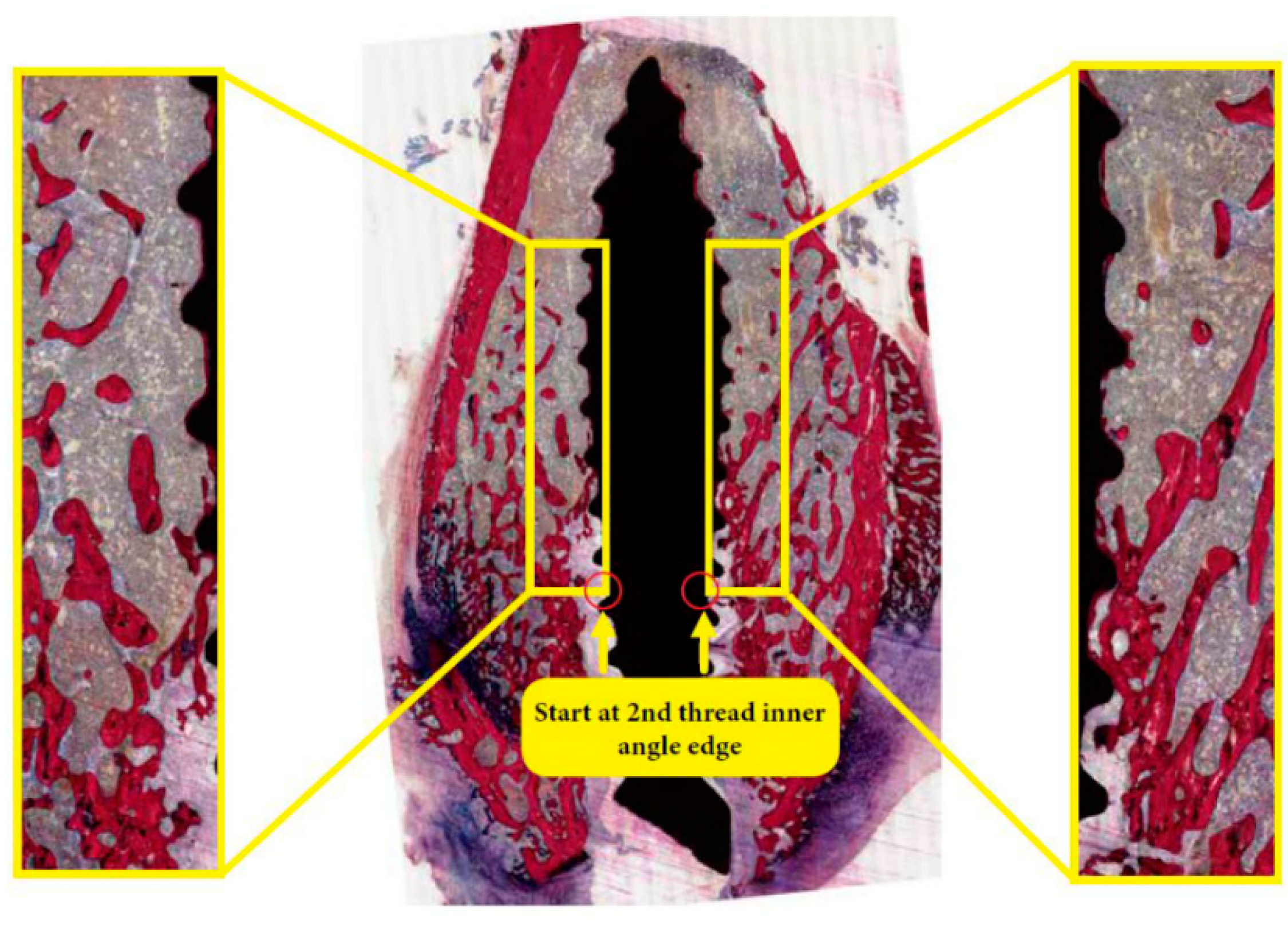 Materials 13 05248 g001