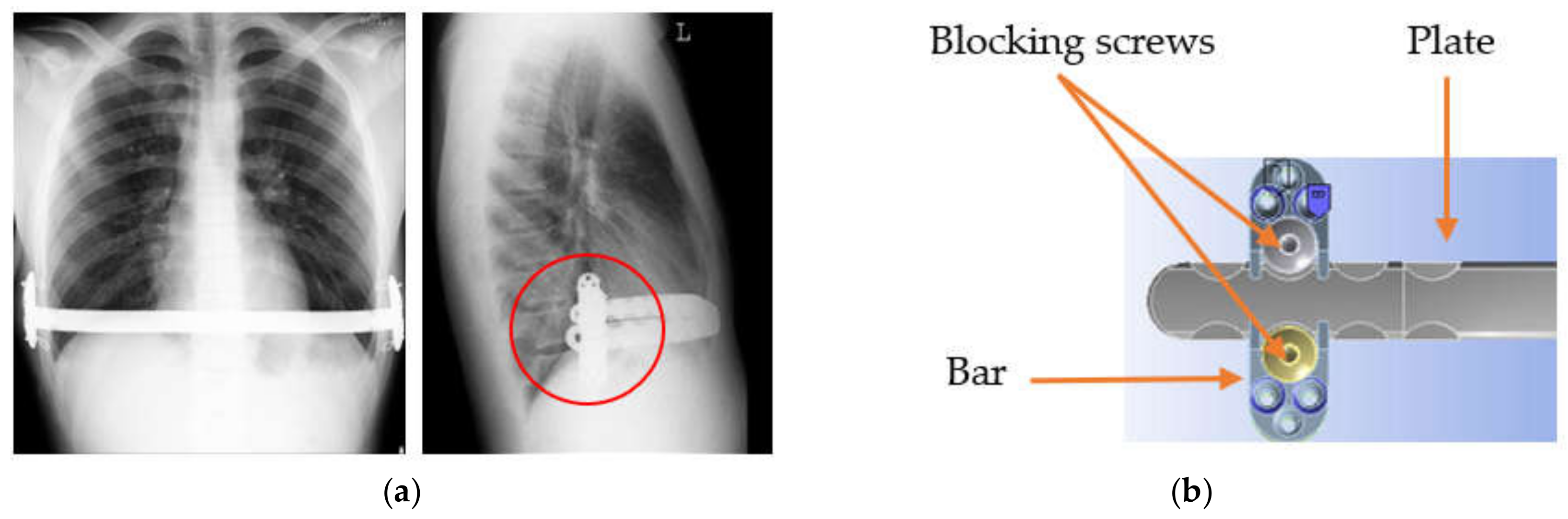 Materials 13 05484 g001