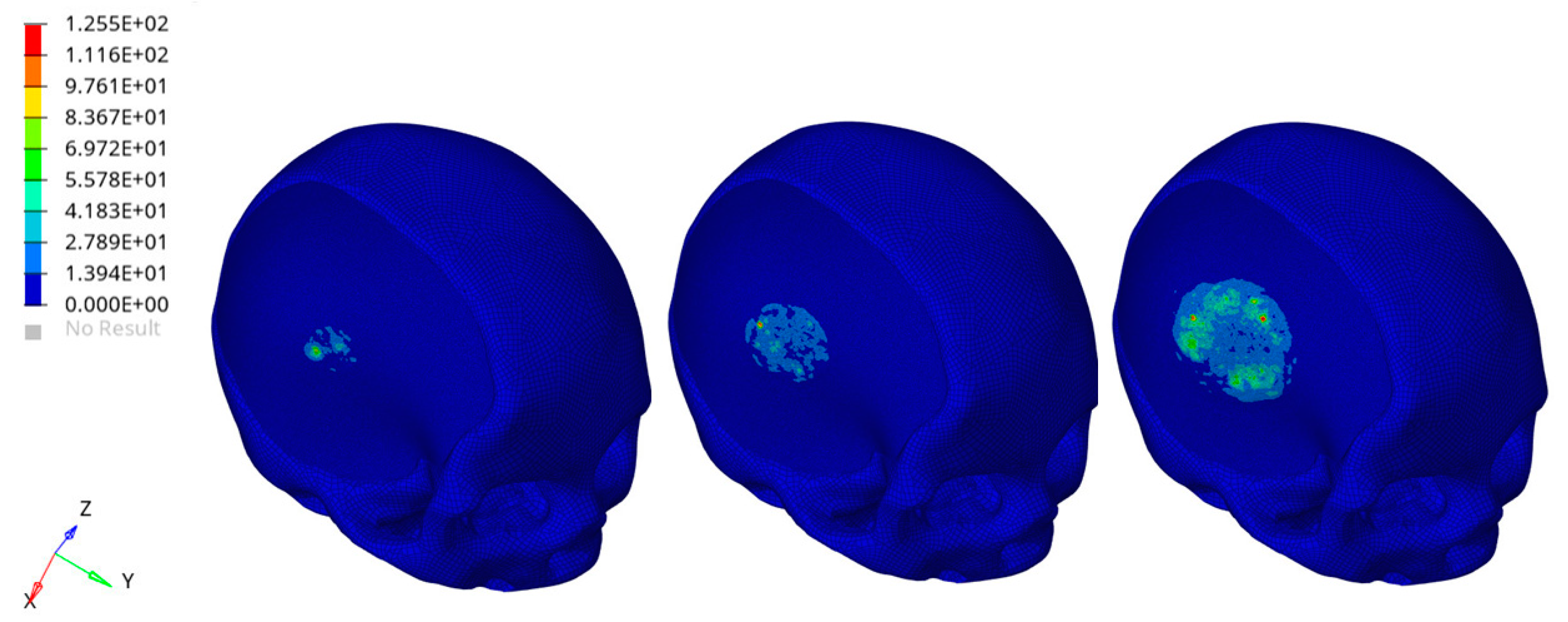 Materials 14 00181 g011 Materials 14 00181 g011