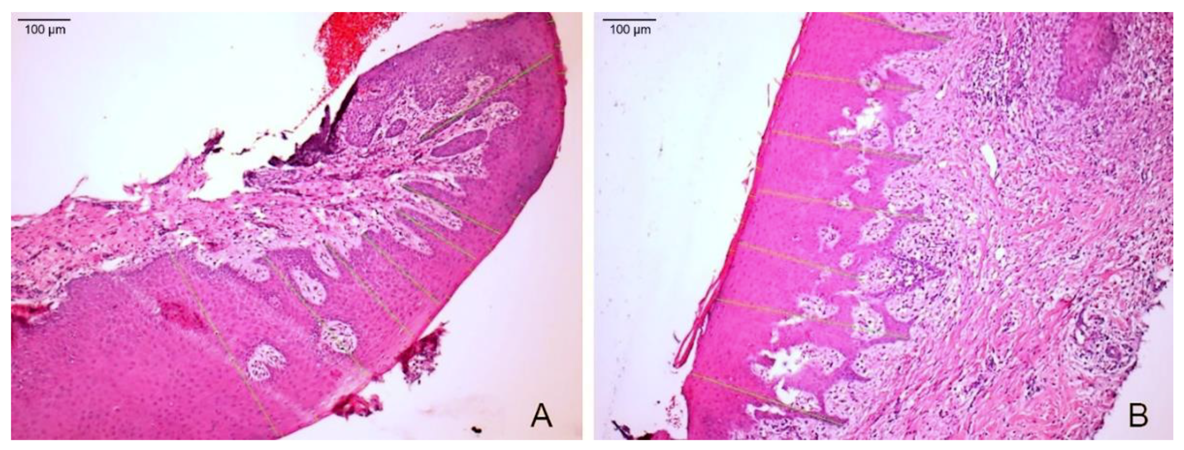 Materials 14 00272 g006